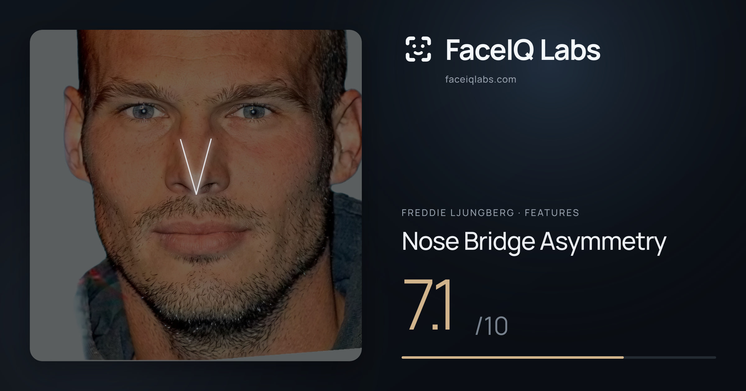 Freddie Ljungberg Nose Bridge Asymmetry: 7.1/10, drawn on the photo
