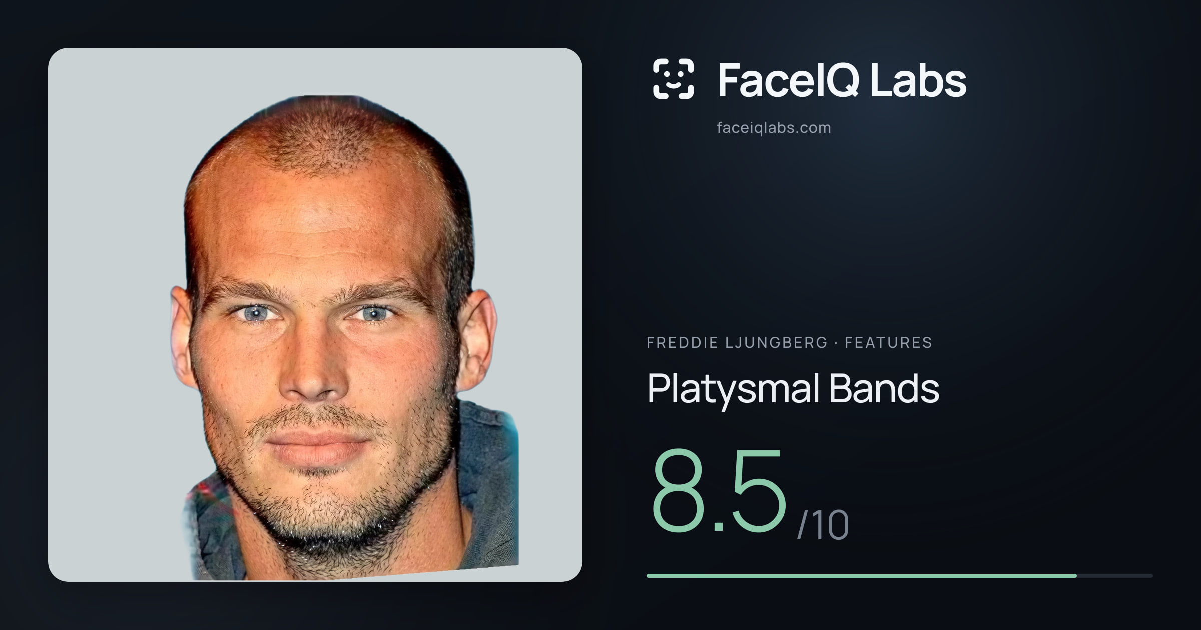 Freddie Ljungberg Platysmal Bands: 8.5/10, drawn on the photo