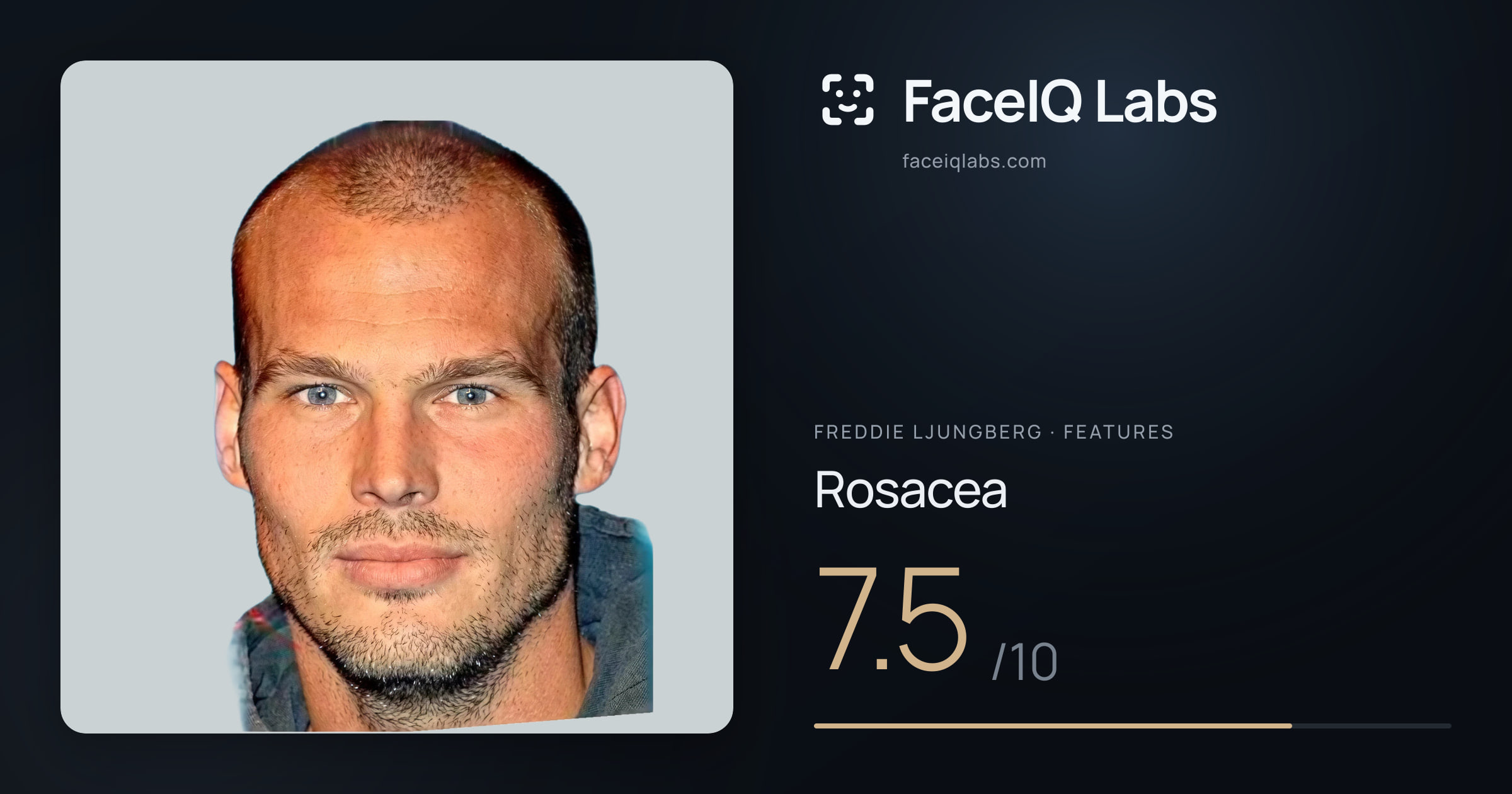 Freddie Ljungberg Rosacea: 7.5/10, drawn on the photo