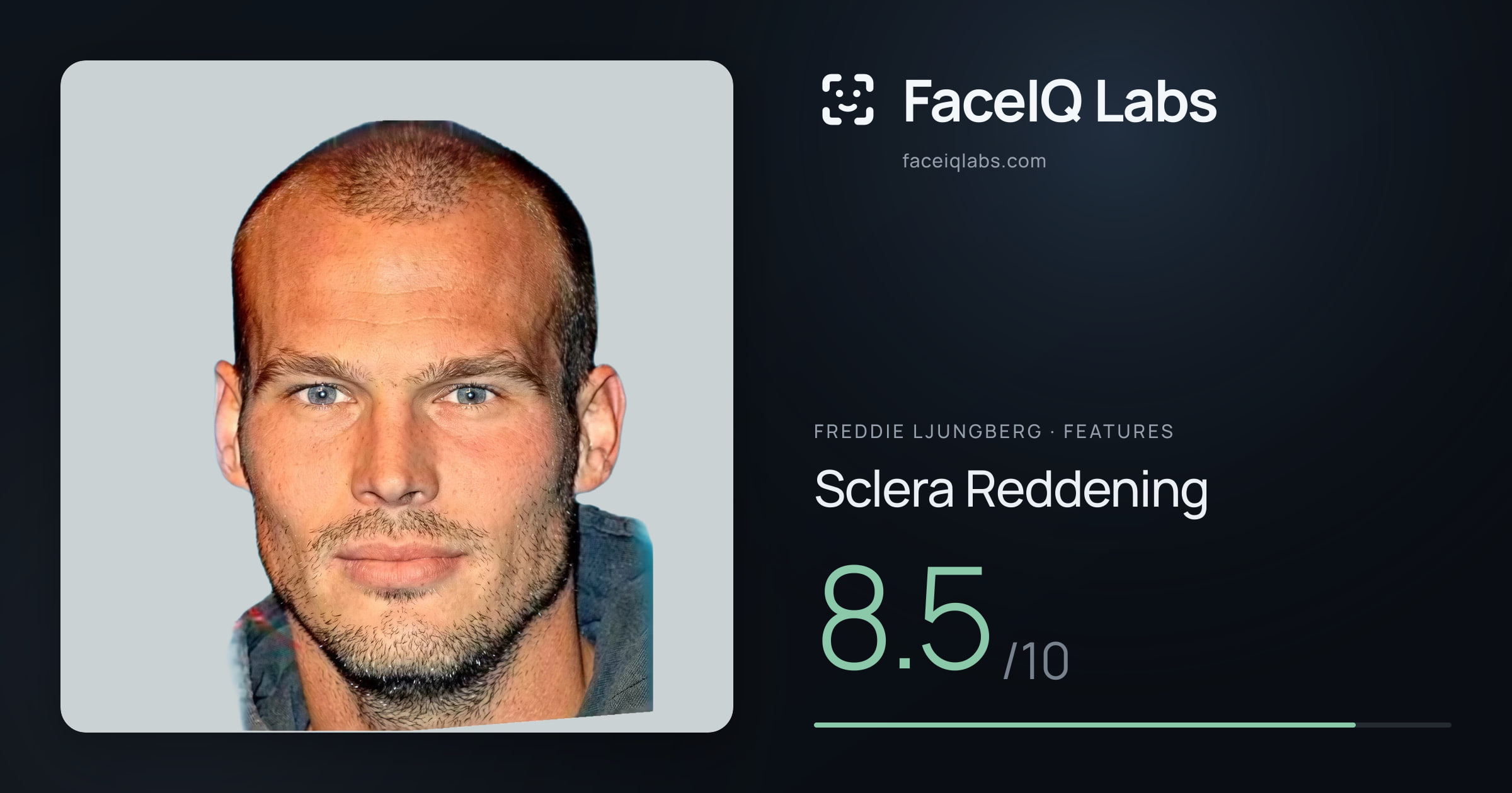 Freddie Ljungberg Sclera Reddening: 8.5/10, drawn on the photo