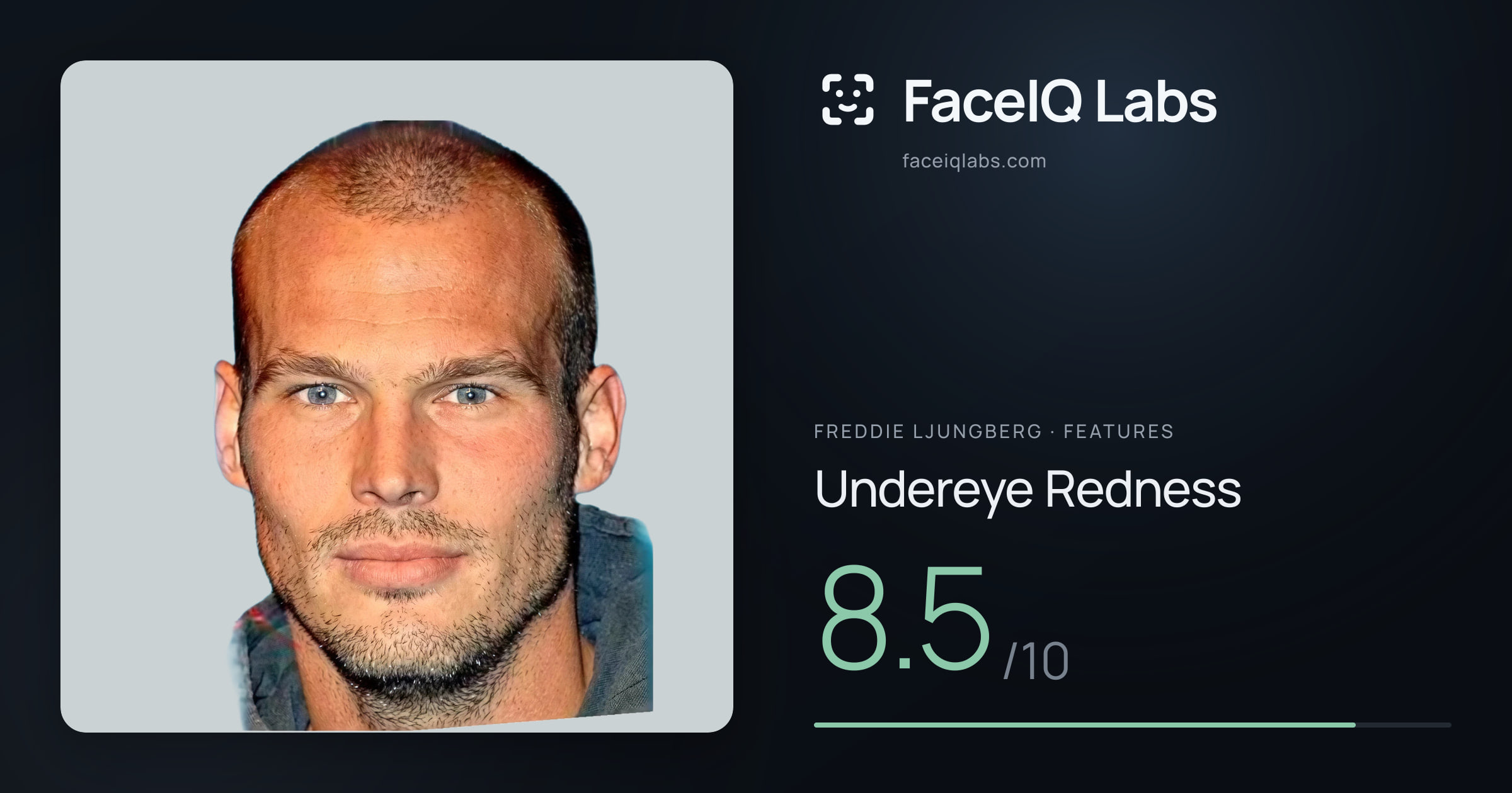 Freddie Ljungberg Undereye Redness: 8.5/10, drawn on the photo