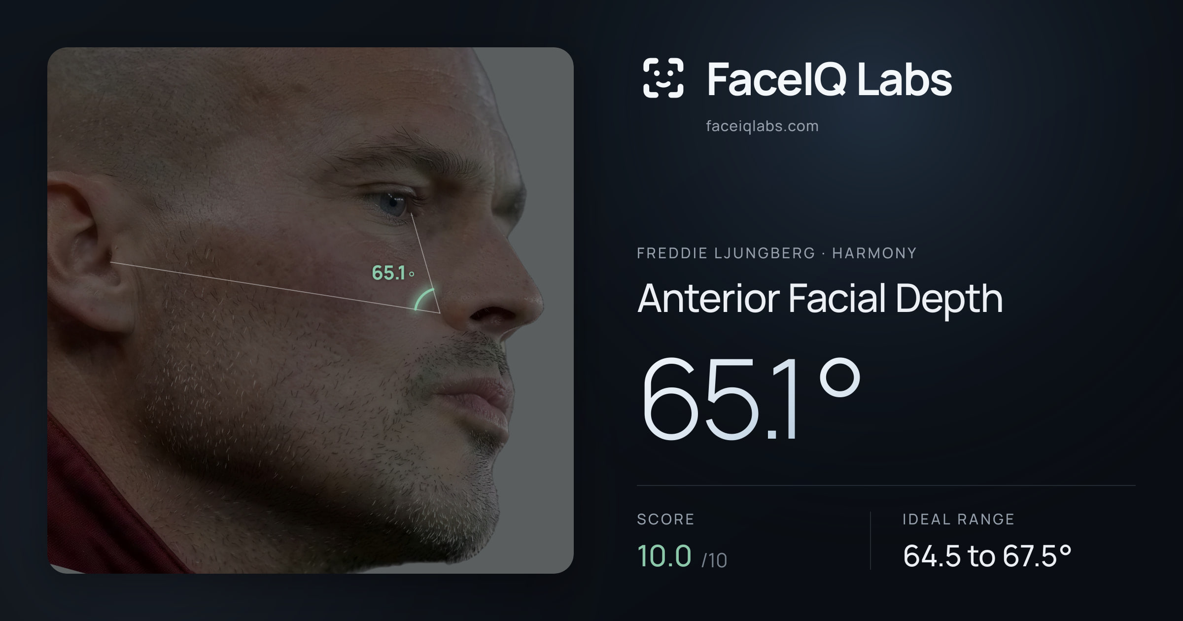 Freddie Ljungberg Anterior Facial Depth: 65.1°, drawn on the photo