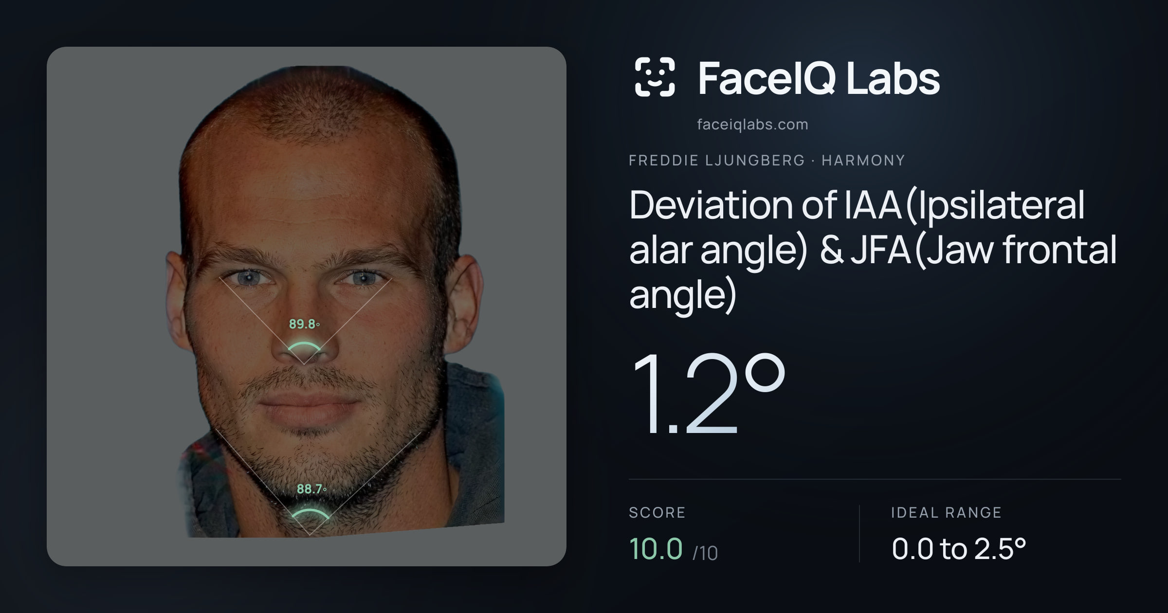 Freddie Ljungberg Deviation of IAA(Ipsilateral alar angle) & JFA(Jaw frontal angle): 1.2°, drawn on the photo