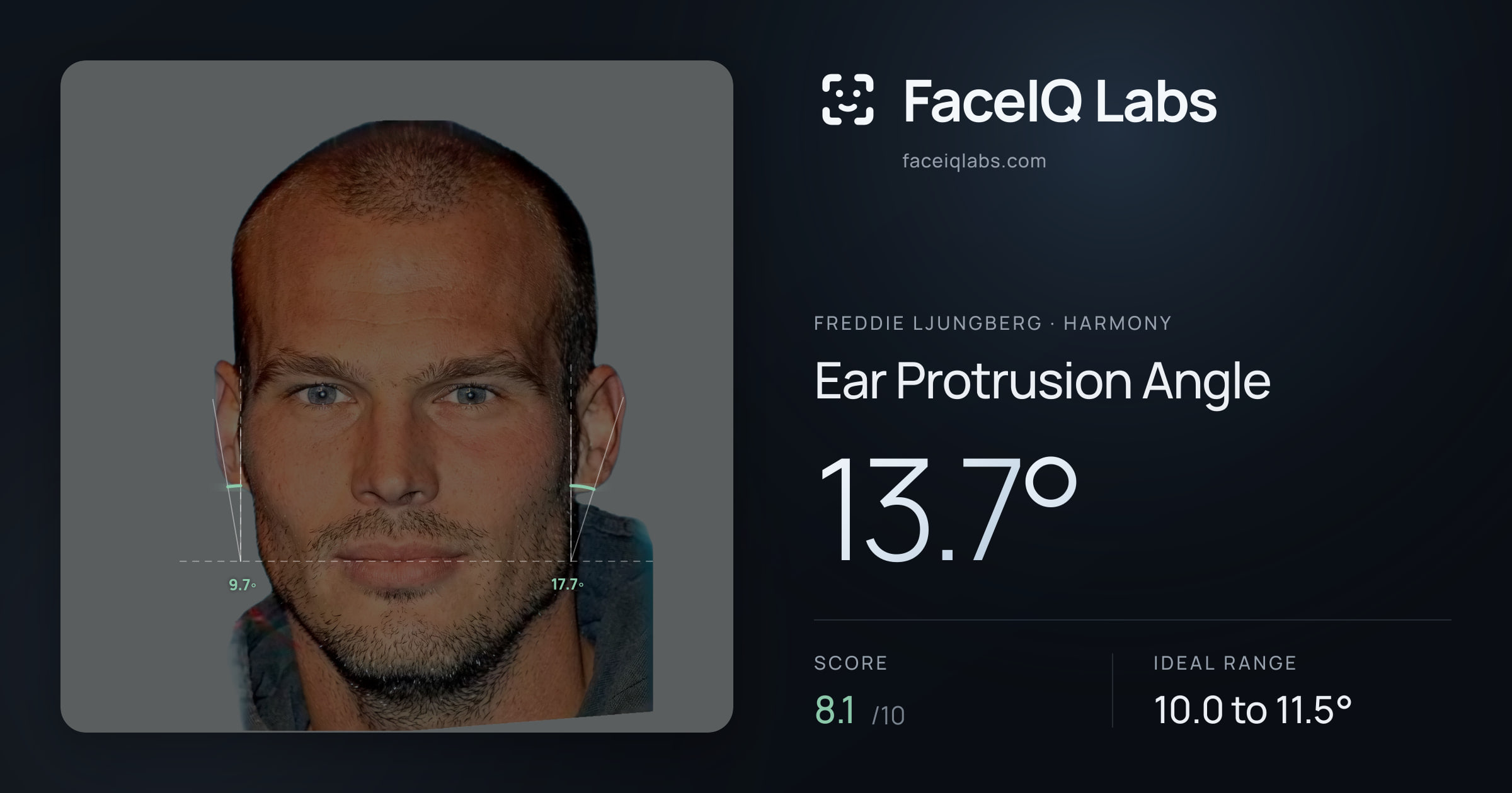 Freddie Ljungberg Ear Protrusion Angle: 13.7°, drawn on the photo