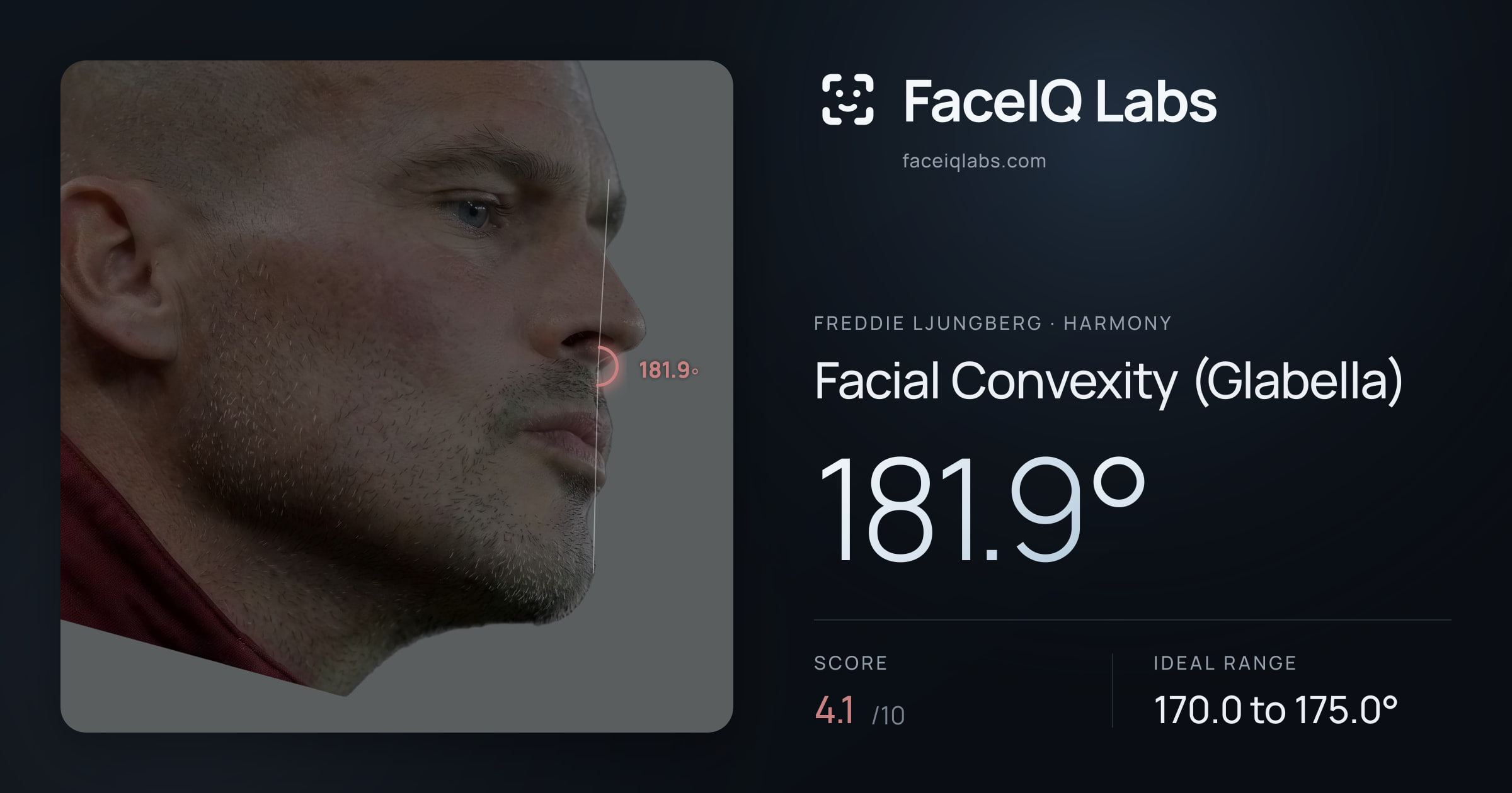 Freddie Ljungberg Facial Convexity (Glabella): 181.9°, drawn on the photo