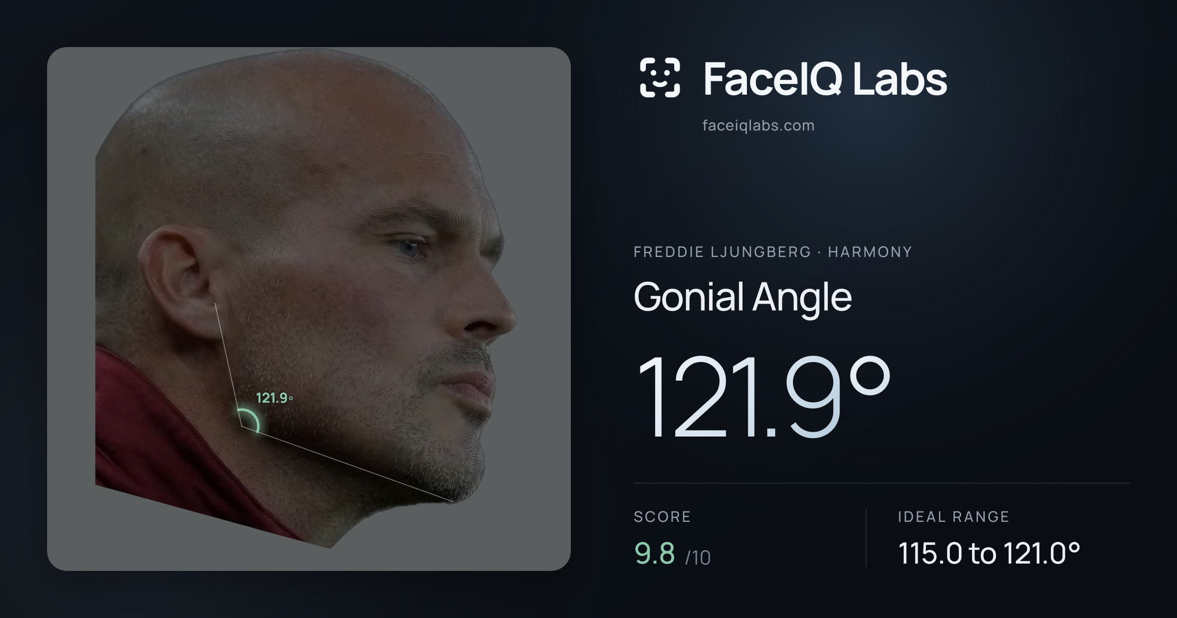 Freddie Ljungberg Gonial Angle: 121.9°, drawn on the photo