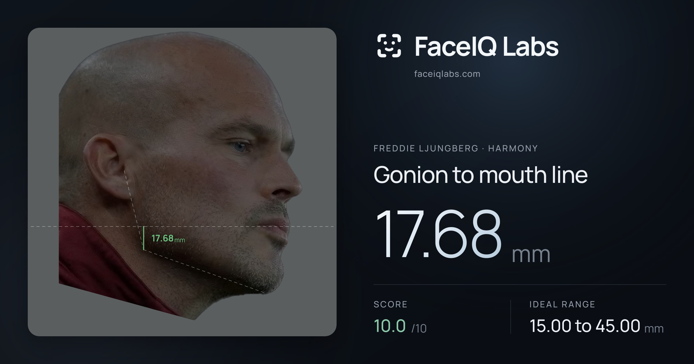 Freddie Ljungberg Gonion to mouth line: 17.68mm, drawn on the photo