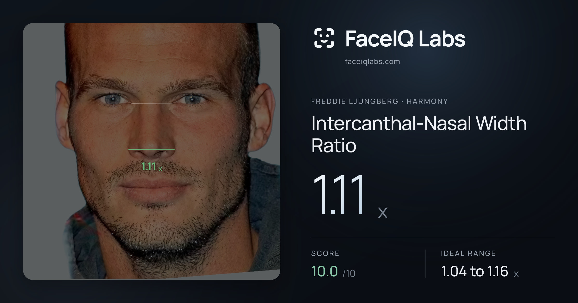Freddie Ljungberg Intercanthal-Nasal Width Ratio: 1.11x, drawn on the photo