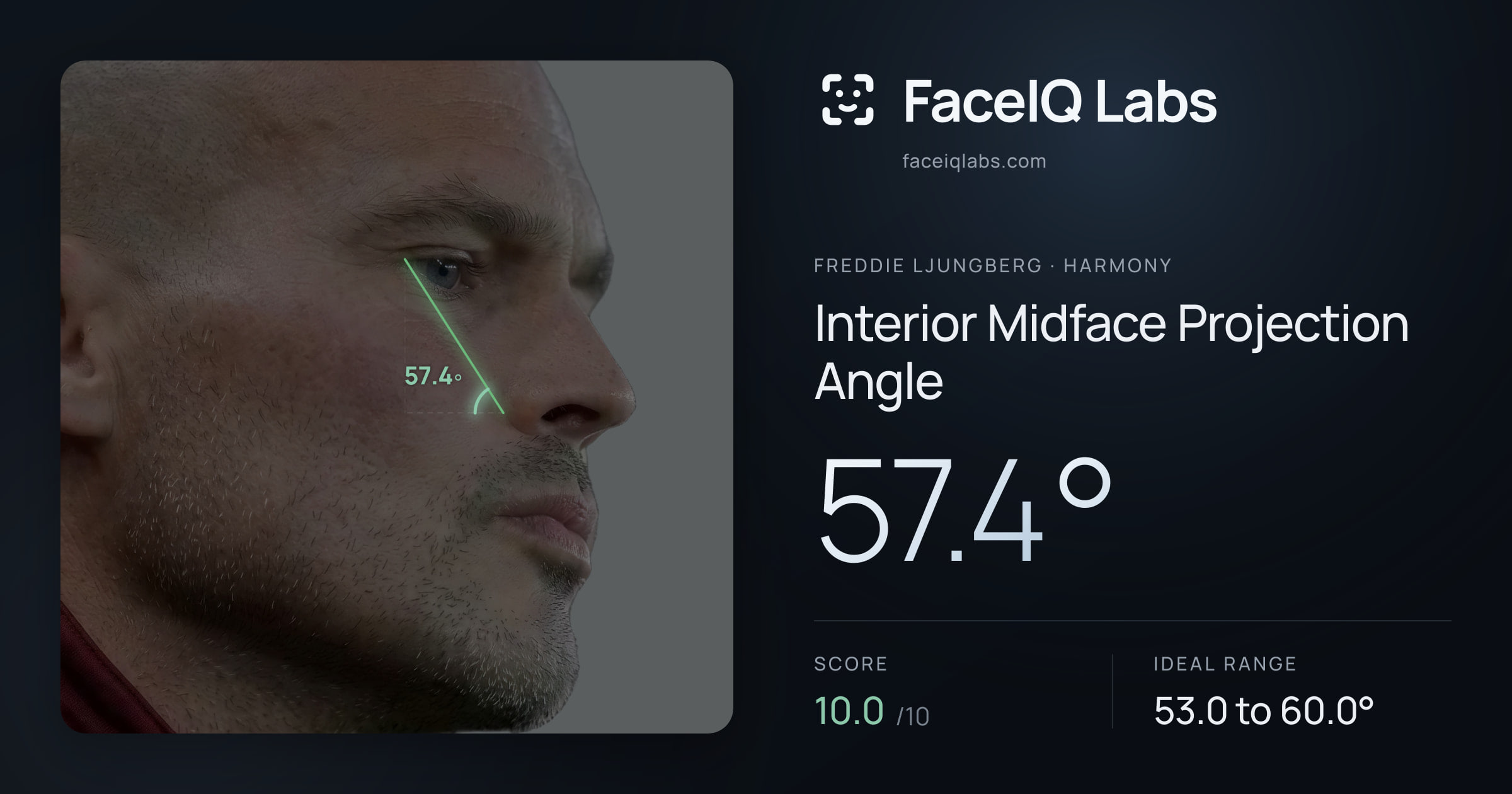 Freddie Ljungberg Interior Midface Projection Angle: 57.4°, drawn on the photo