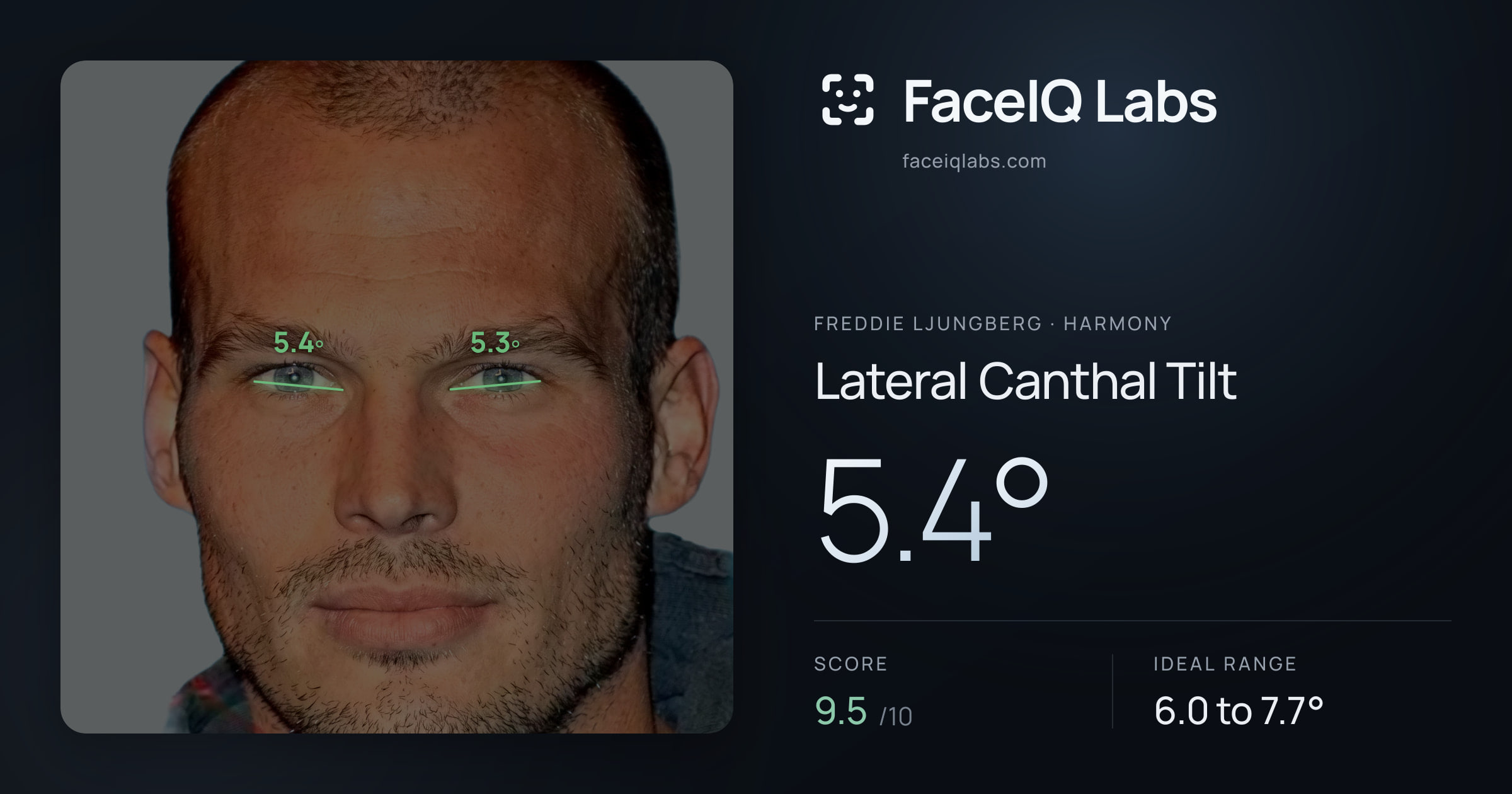 Freddie Ljungberg Lateral Canthal Tilt: 5.4°, drawn on the photo