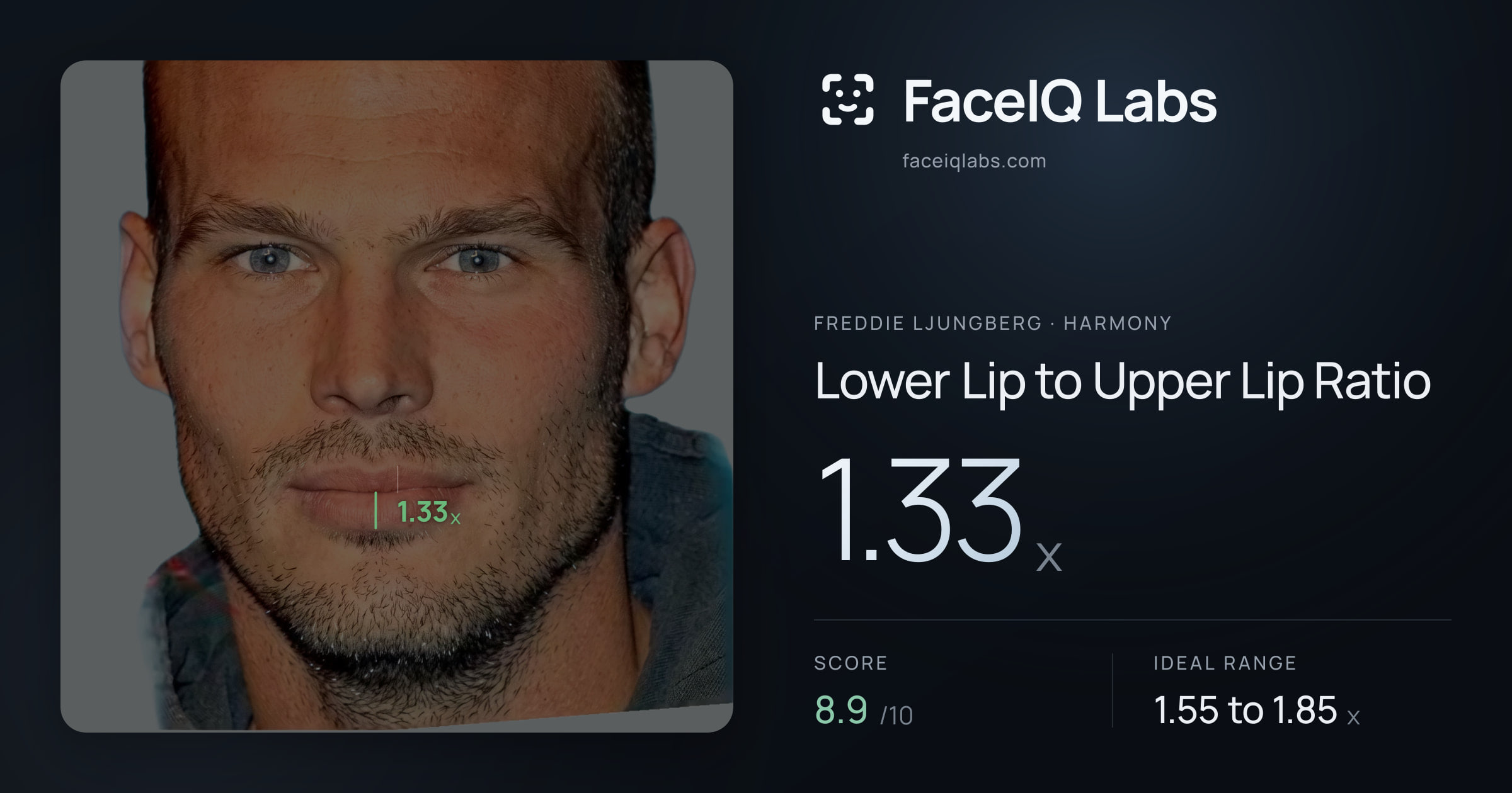 Freddie Ljungberg Lower Lip to Upper Lip Ratio: 1.33x, drawn on the photo