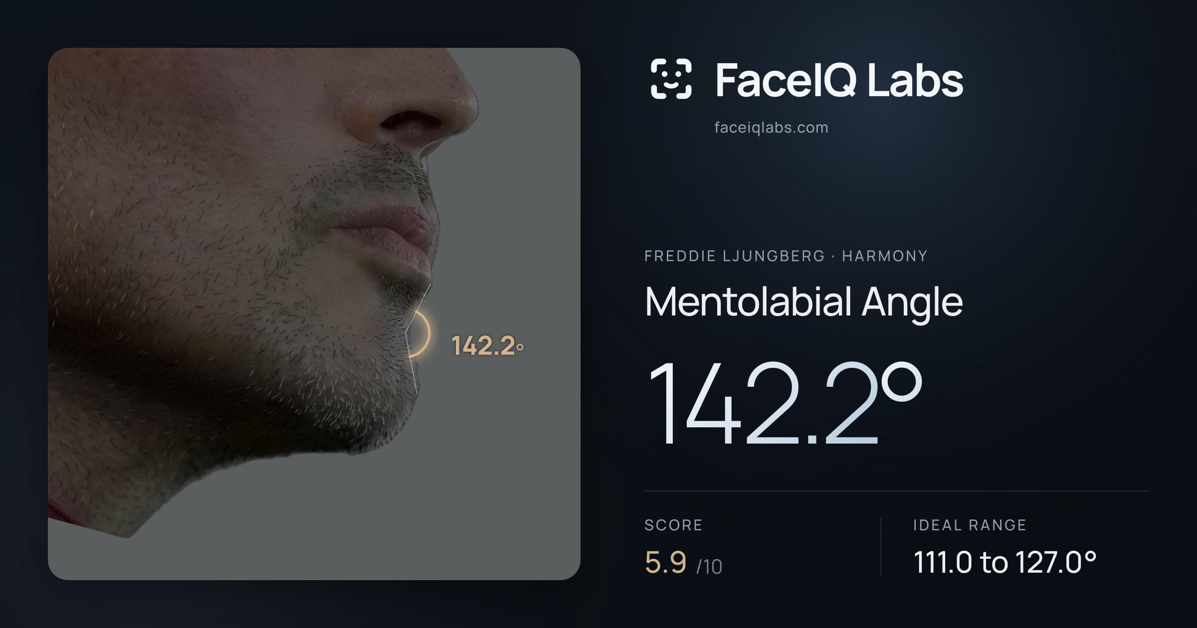 Freddie Ljungberg Mentolabial Angle: 142.2°, drawn on the photo