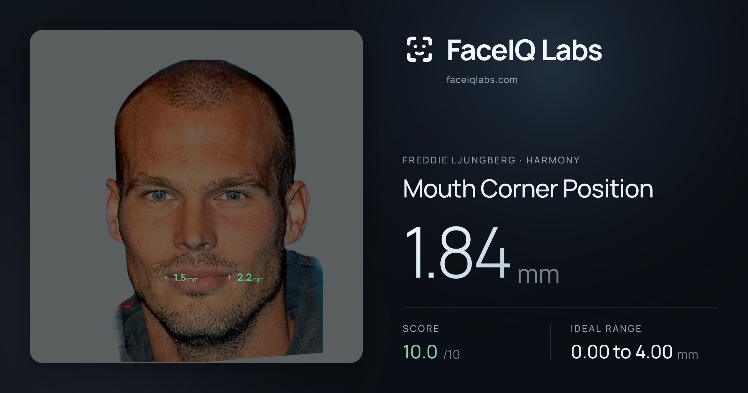 Freddie Ljungberg Mouth Corner Position: 1.84mm, drawn on the photo