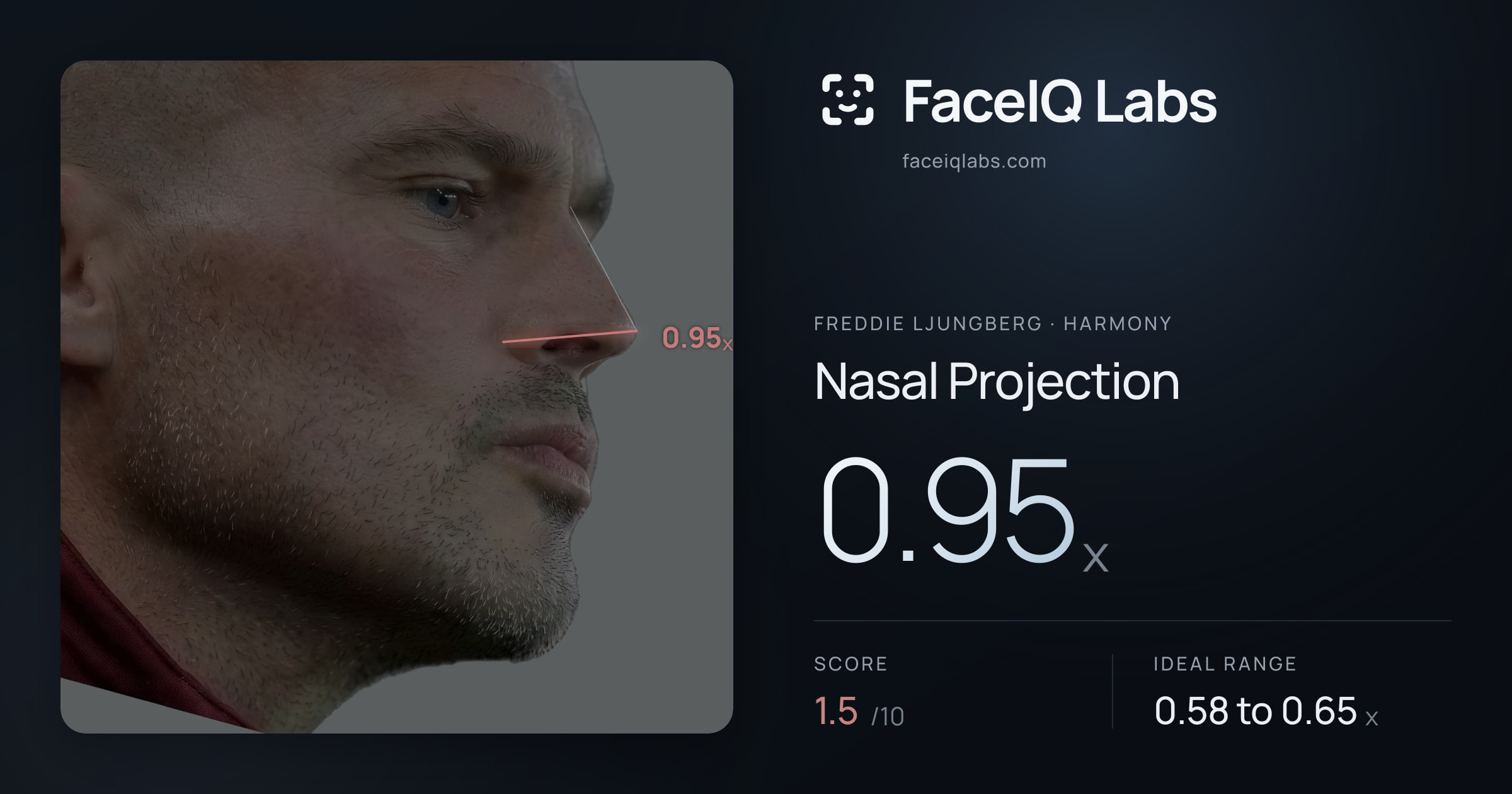 Freddie Ljungberg Nasal Projection: 0.95x, drawn on the photo