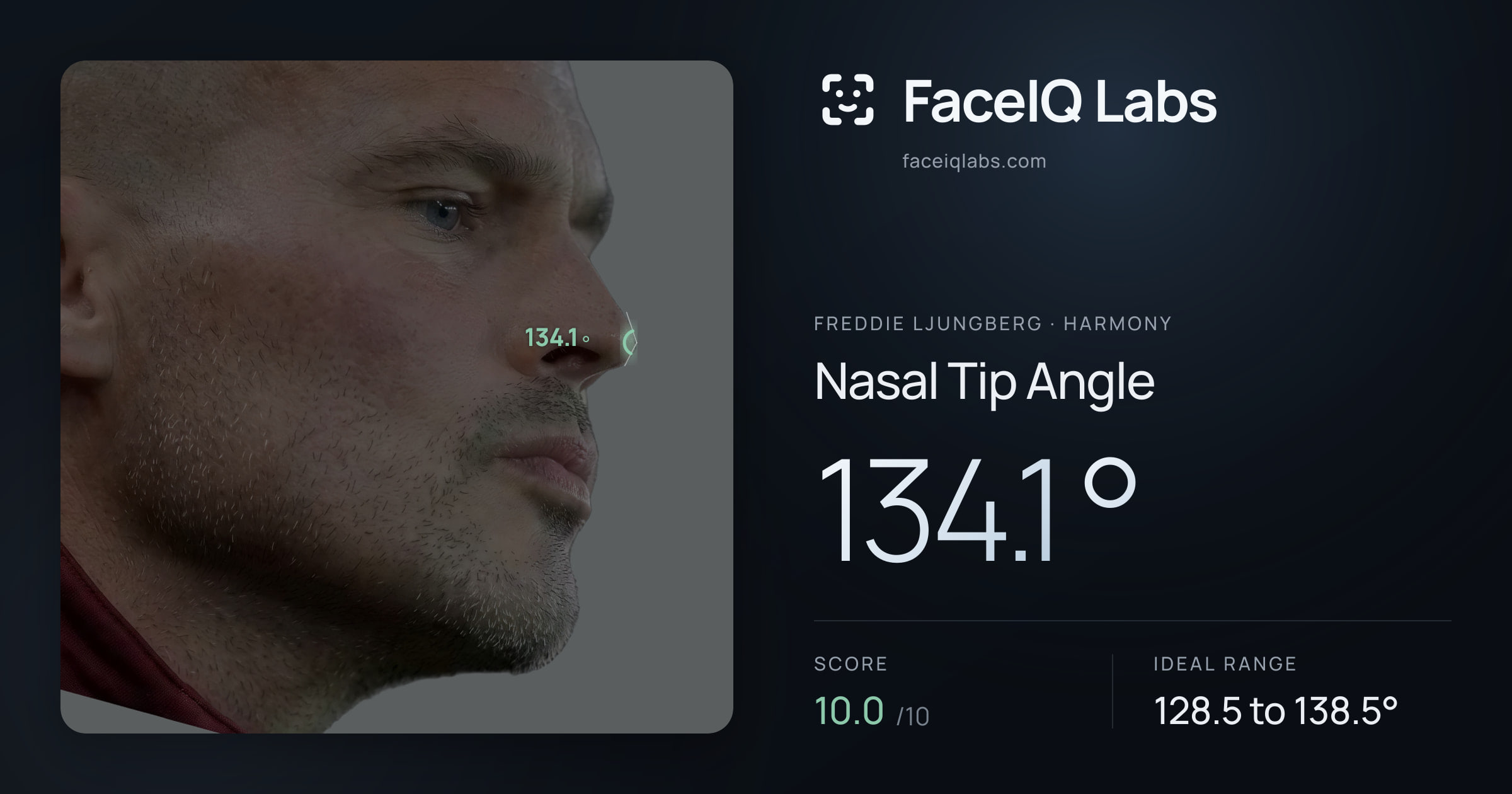 Freddie Ljungberg Nasal Tip Angle: 134.1°, drawn on the photo