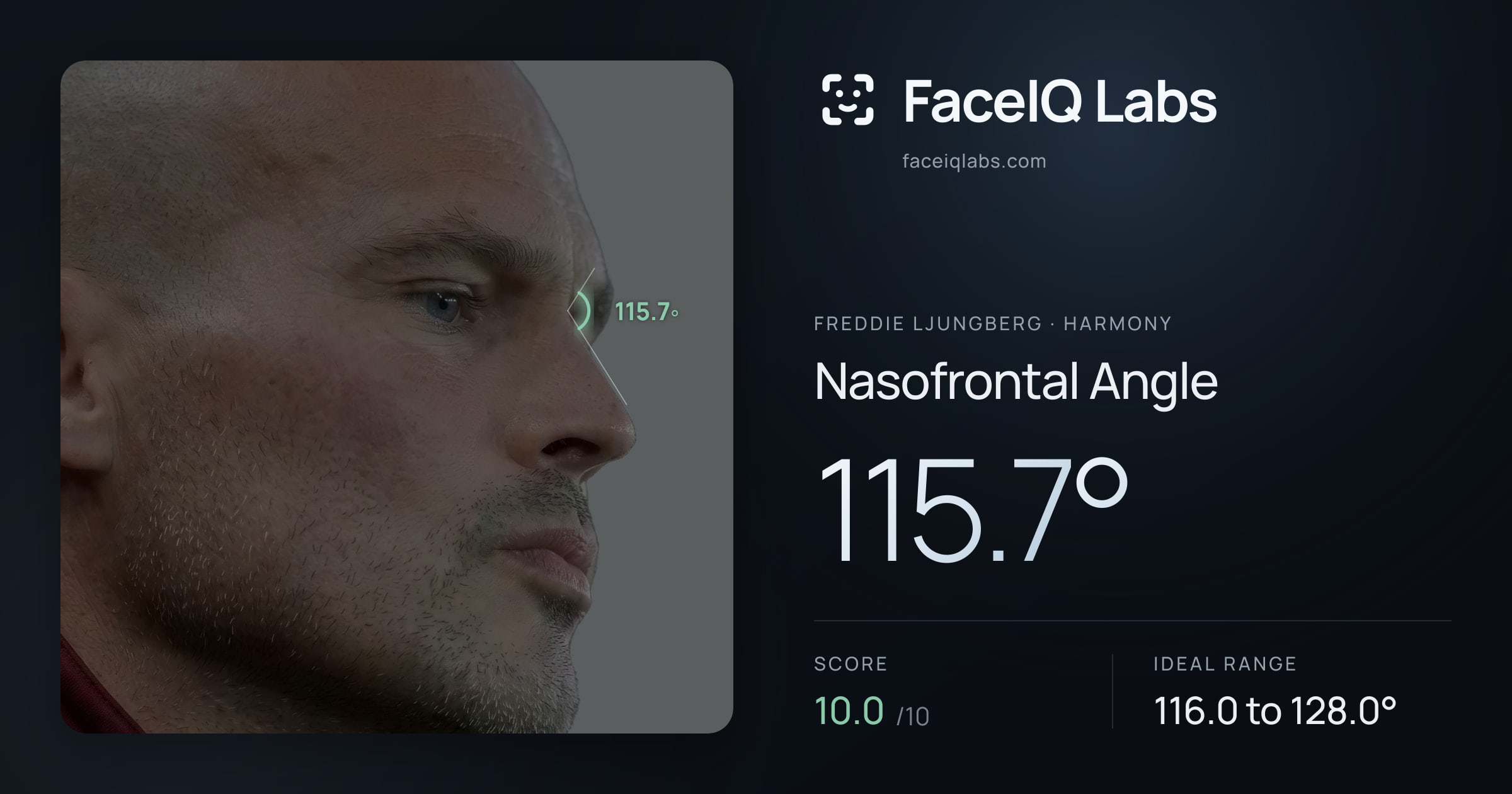 Freddie Ljungberg Nasofrontal Angle: 115.7°, drawn on the photo