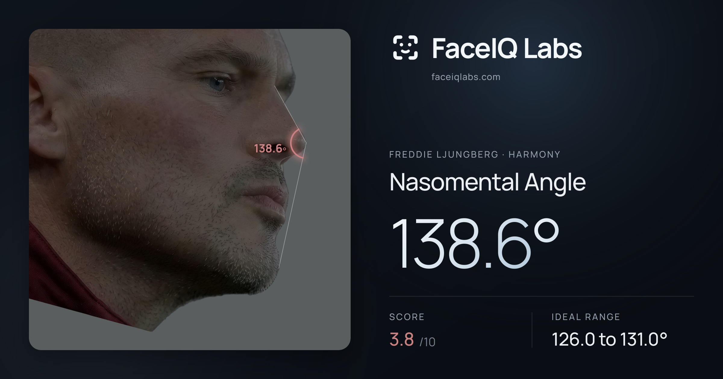 Freddie Ljungberg Nasomental Angle: 138.6°, drawn on the photo