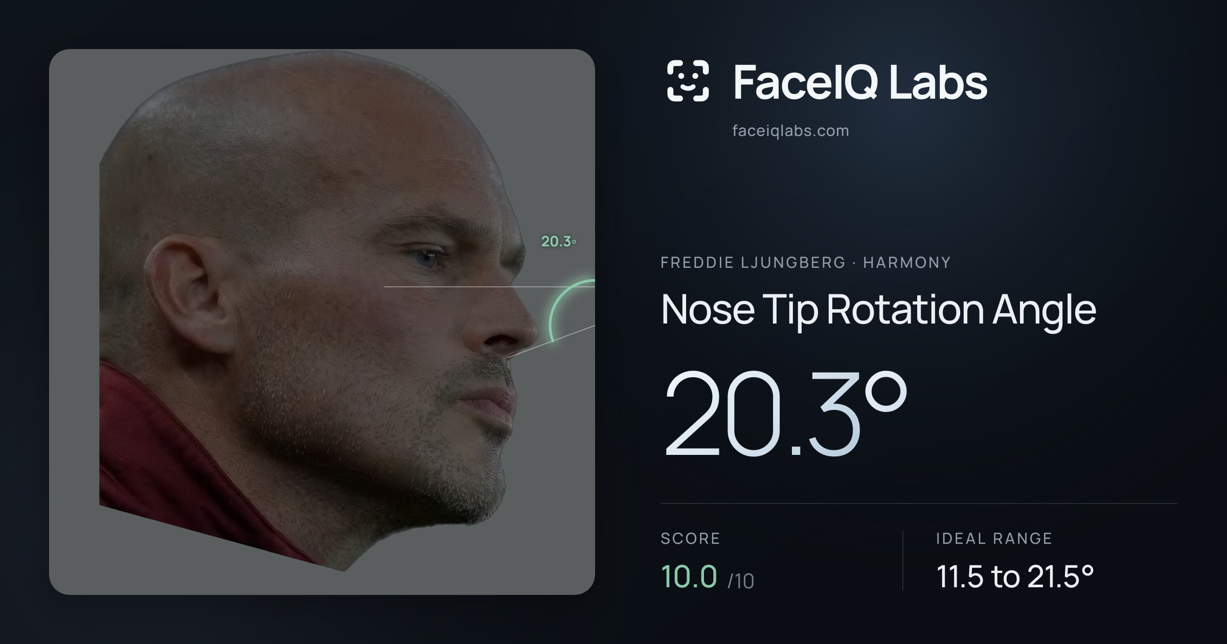 Freddie Ljungberg Nose Tip Rotation Angle: 20.3°, drawn on the photo