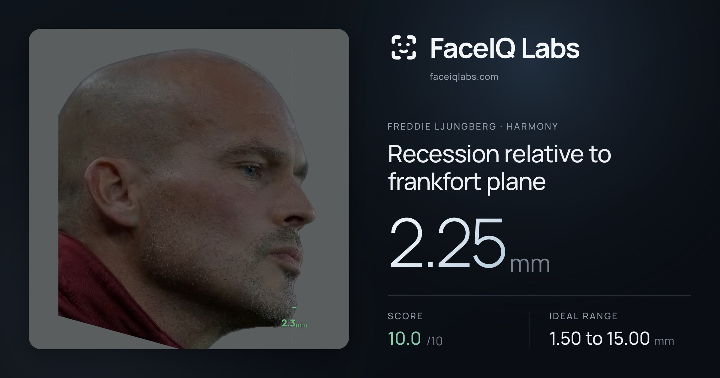 Freddie Ljungberg Recession relative to frankfort plane: 2.25mm, drawn on the photo