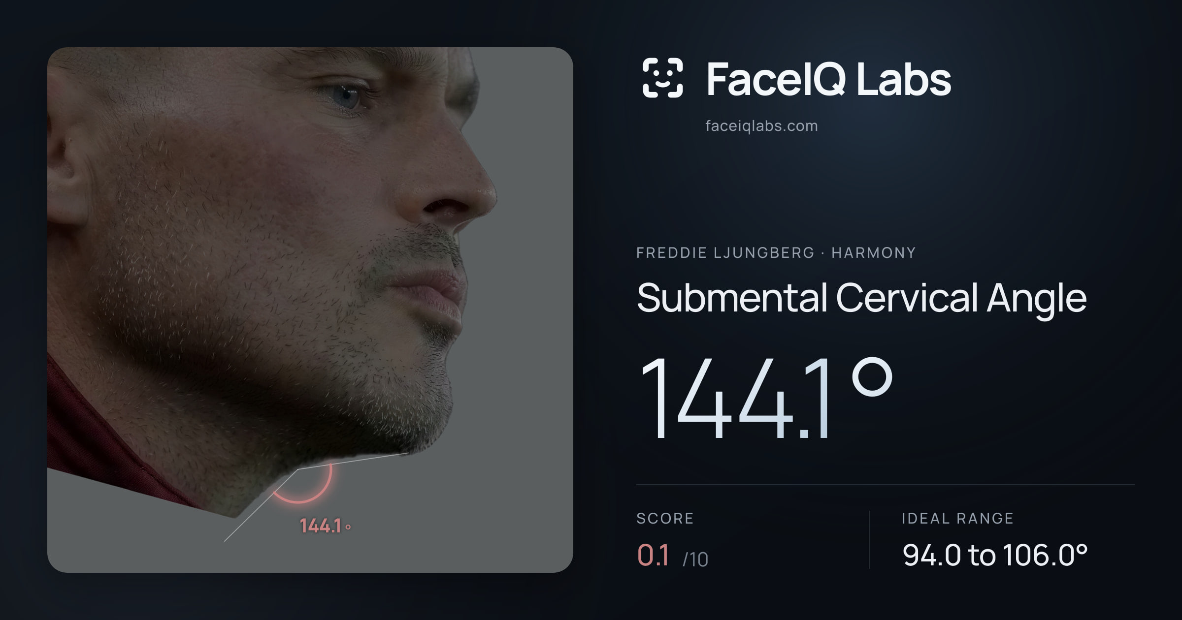 Freddie Ljungberg Submental Cervical Angle: 144.1°, drawn on the photo
