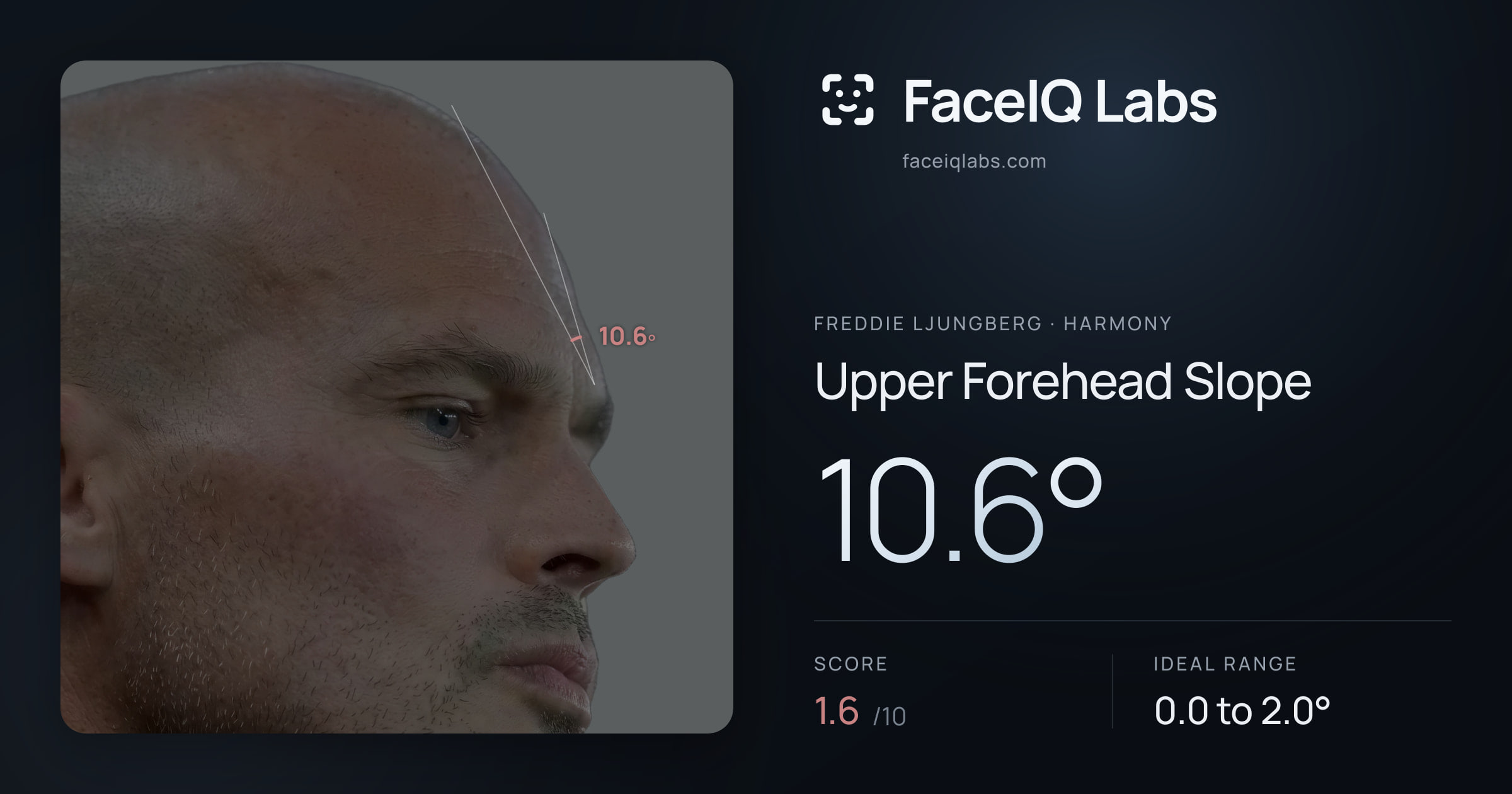 Freddie Ljungberg Upper Forehead Slope: 10.6°, drawn on the photo