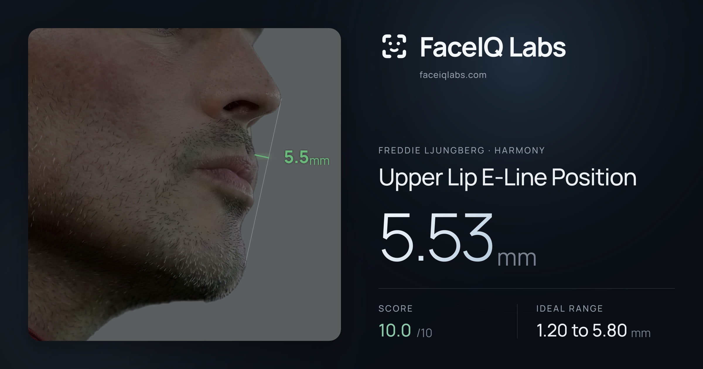 Freddie Ljungberg Upper Lip E-Line Position: 5.53mm, drawn on the photo