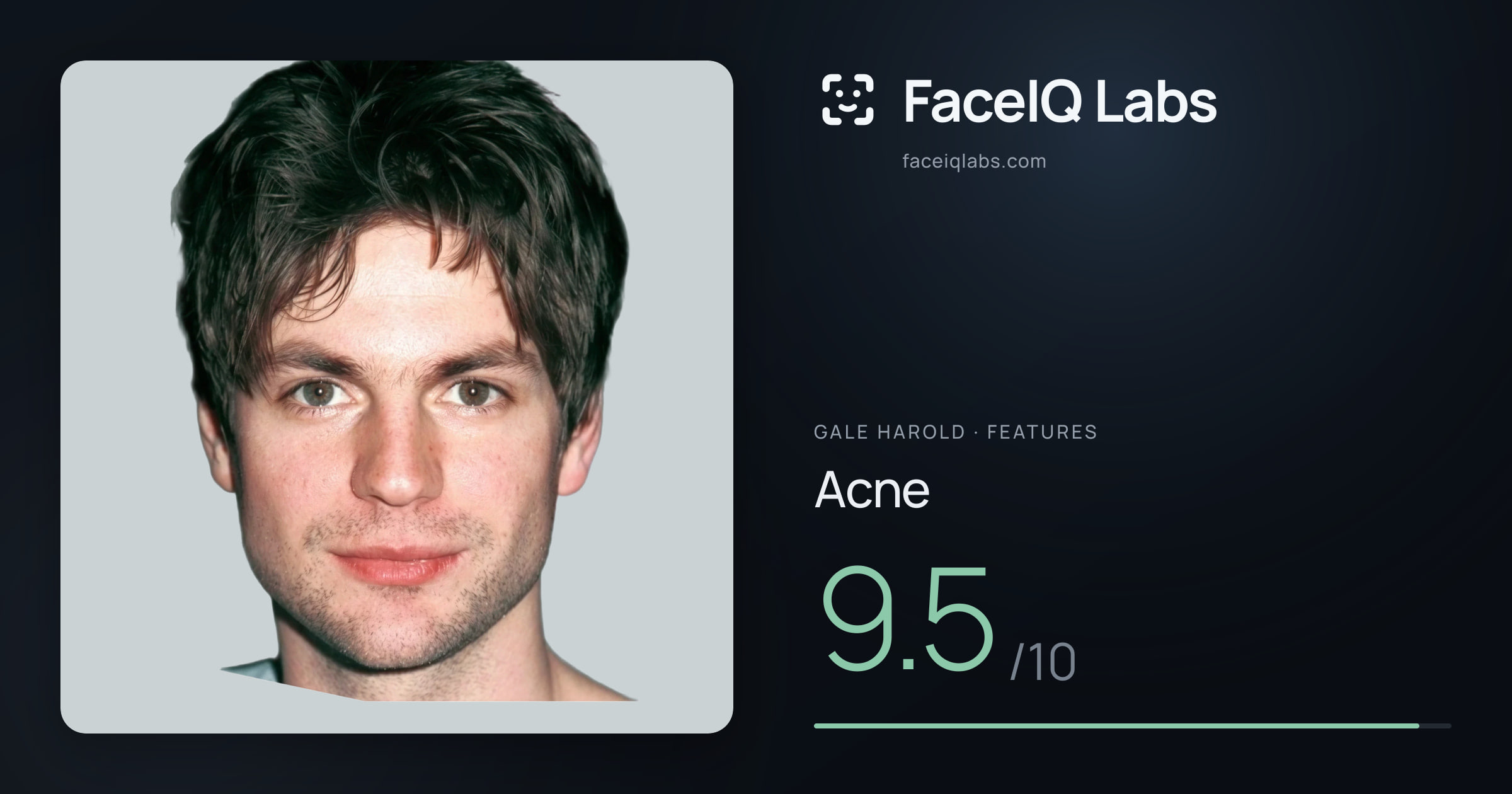 Gale Harold Acne: 9.5/10, drawn on the photo