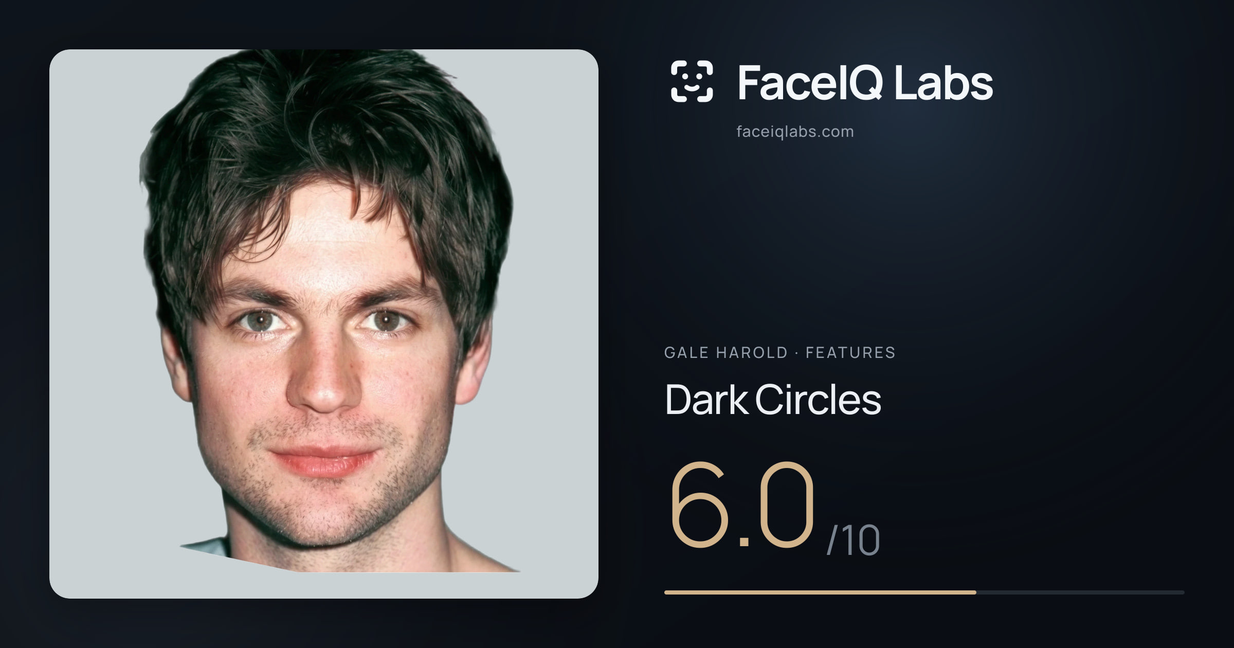 Gale Harold Dark Circles: 6.0/10, drawn on the photo