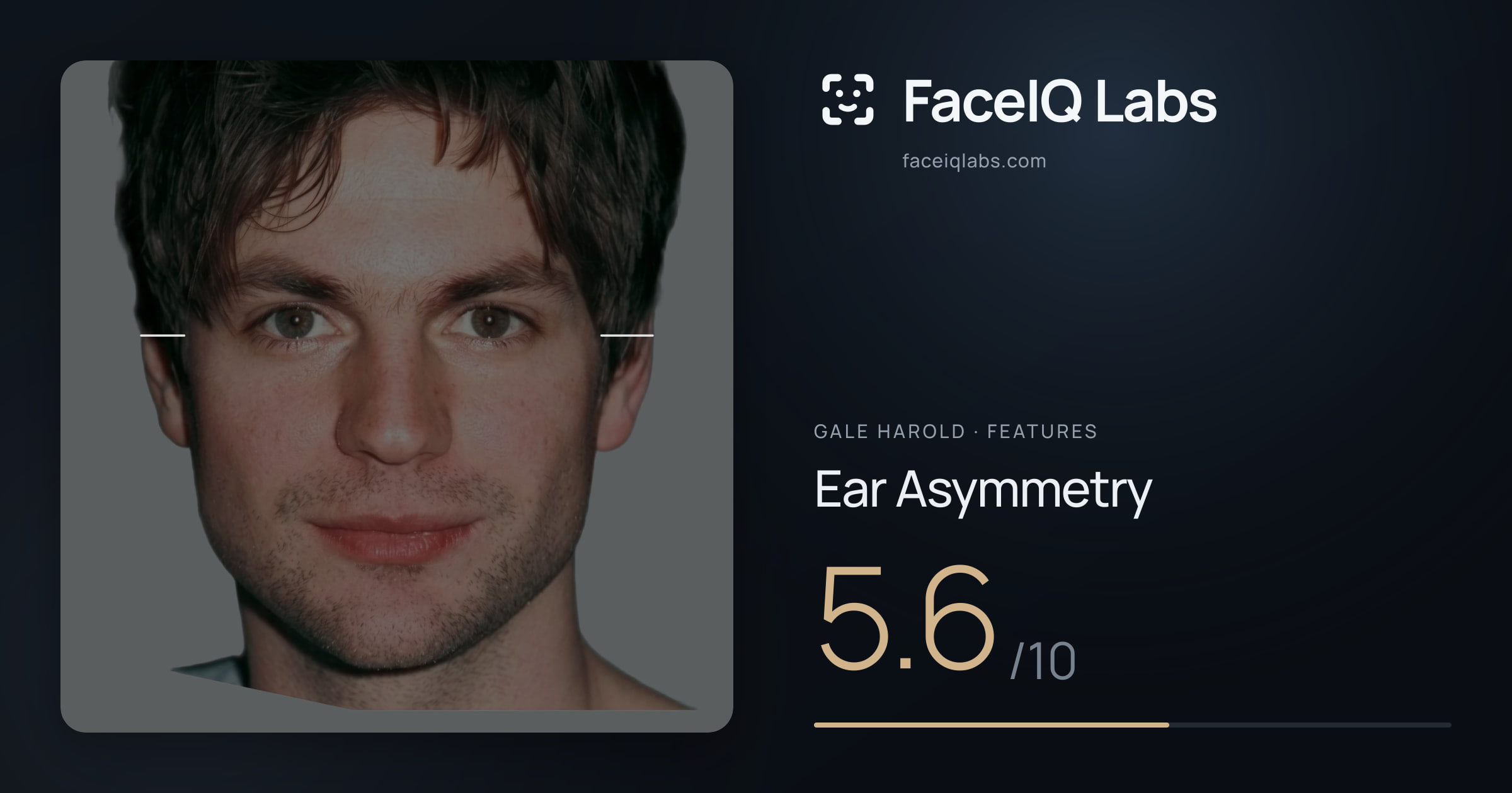 Gale Harold Ear Asymmetry: 5.6/10, drawn on the photo