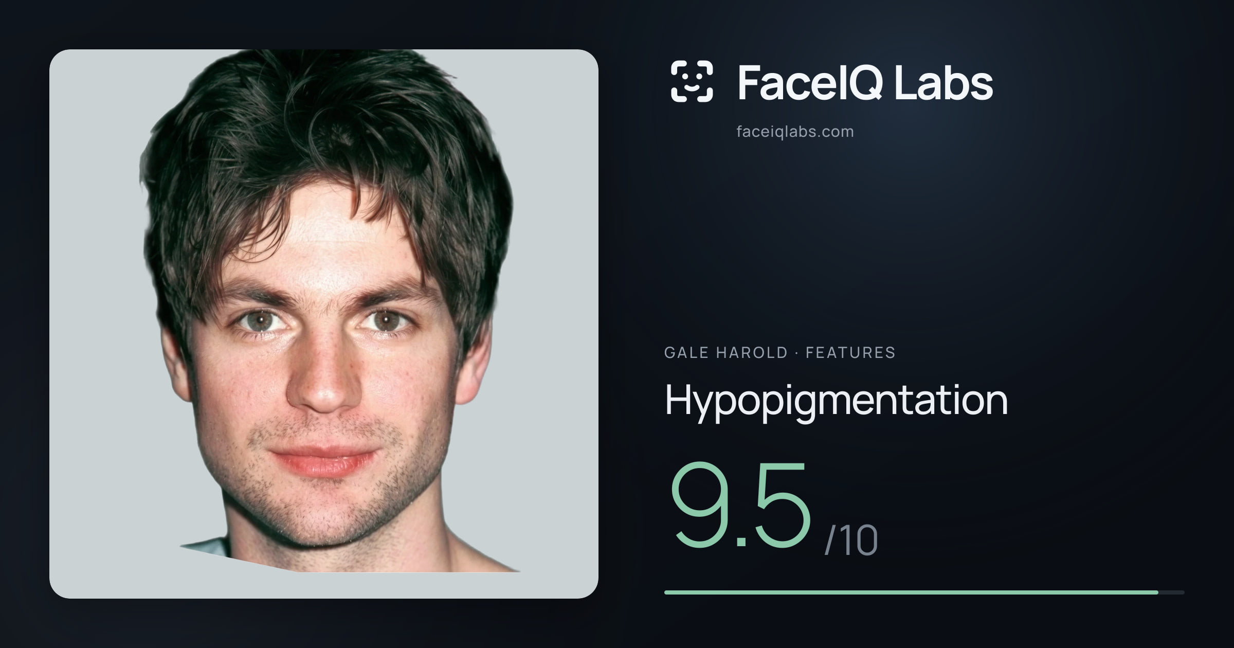 Gale Harold Hypopigmentation: 9.5/10, drawn on the photo