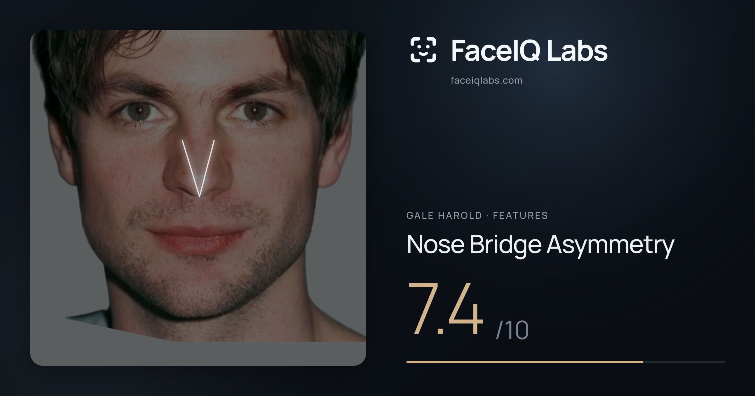 Gale Harold Nose Bridge Asymmetry: 7.4/10, drawn on the photo