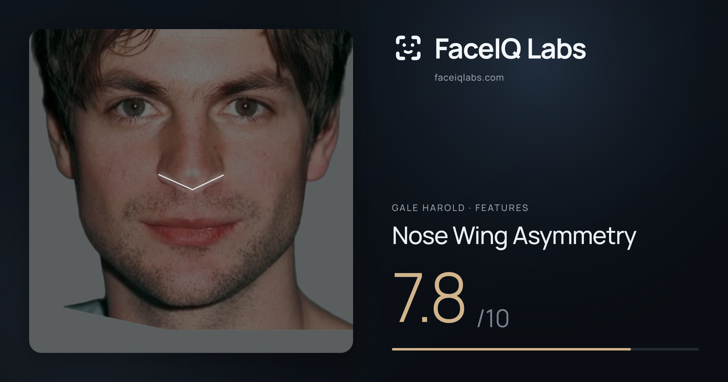 Gale Harold Nose Wing Asymmetry: 7.8/10, drawn on the photo