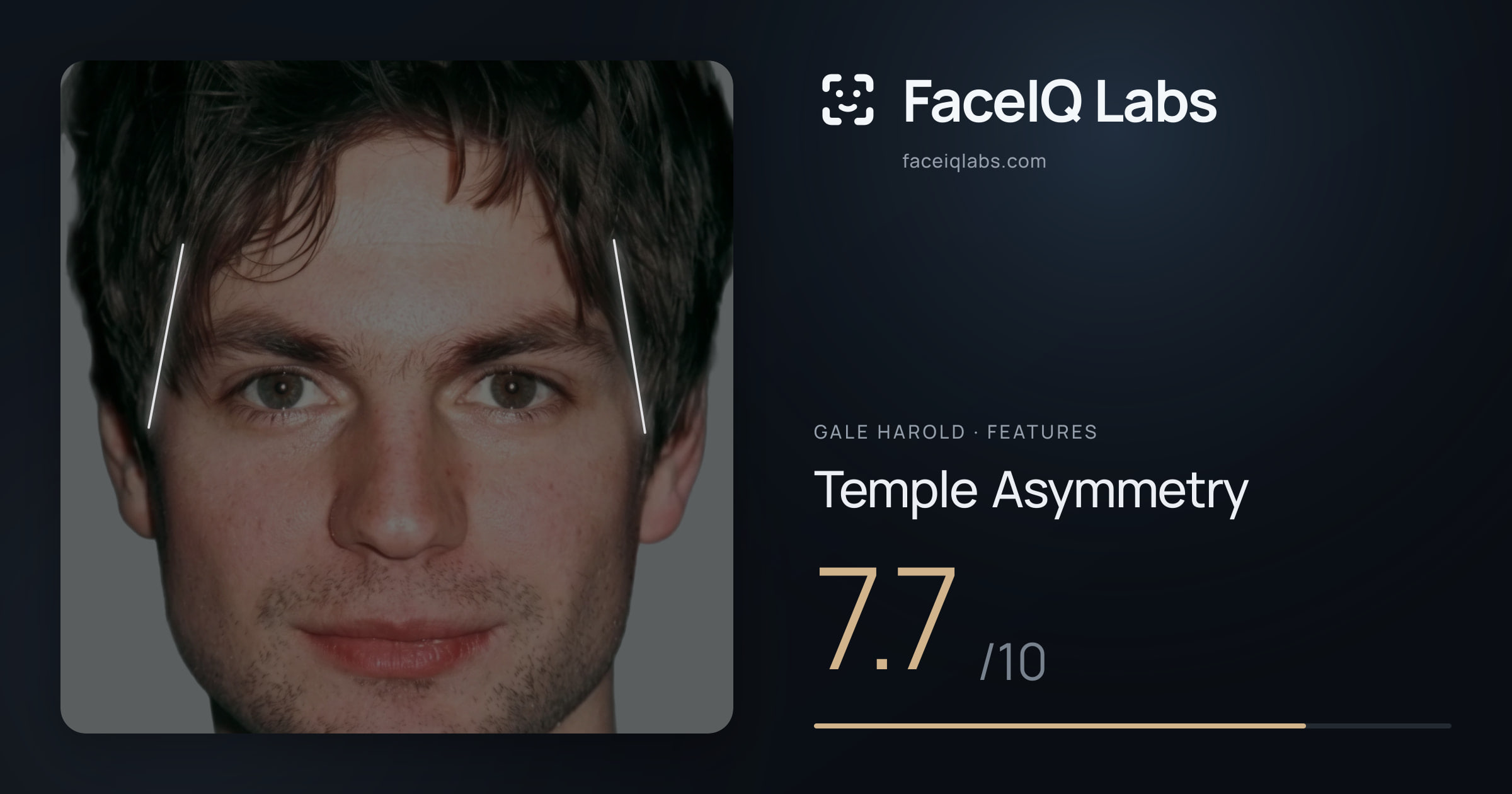Gale Harold Temple Asymmetry: 7.7/10, drawn on the photo