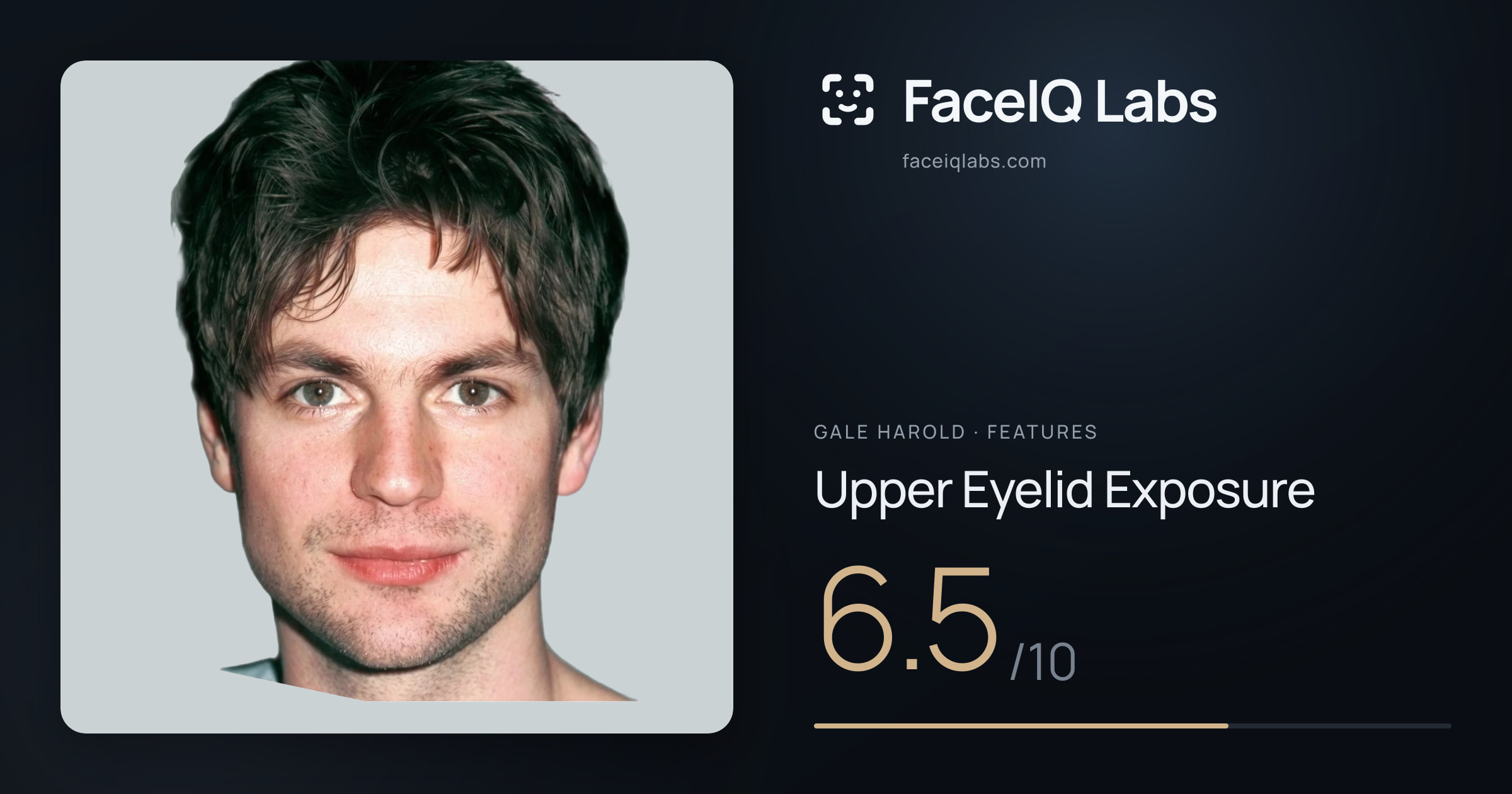 Gale Harold Upper Eyelid Exposure: 6.5/10, drawn on the photo