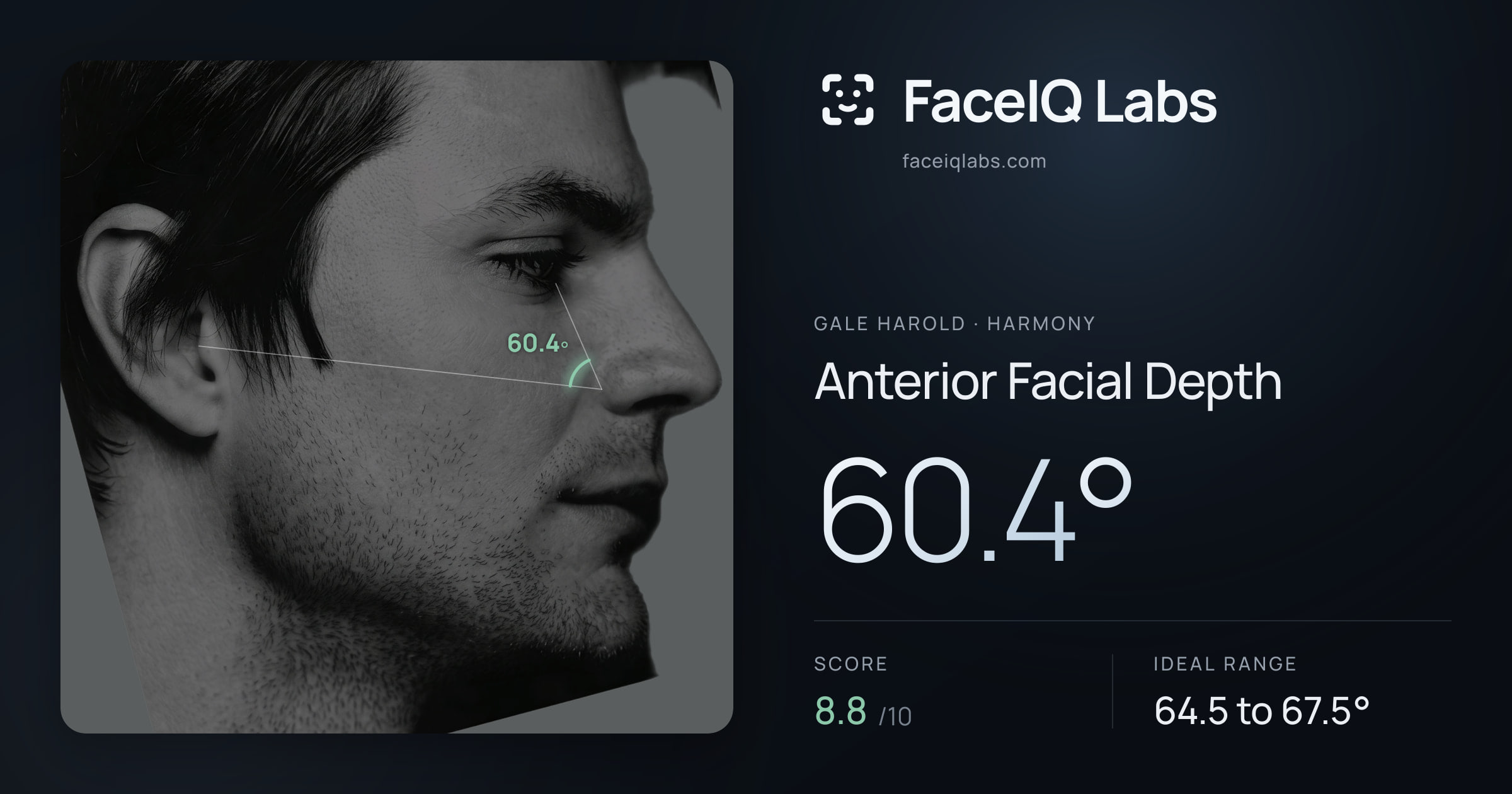 Gale Harold Anterior Facial Depth: 60.4°, drawn on the photo