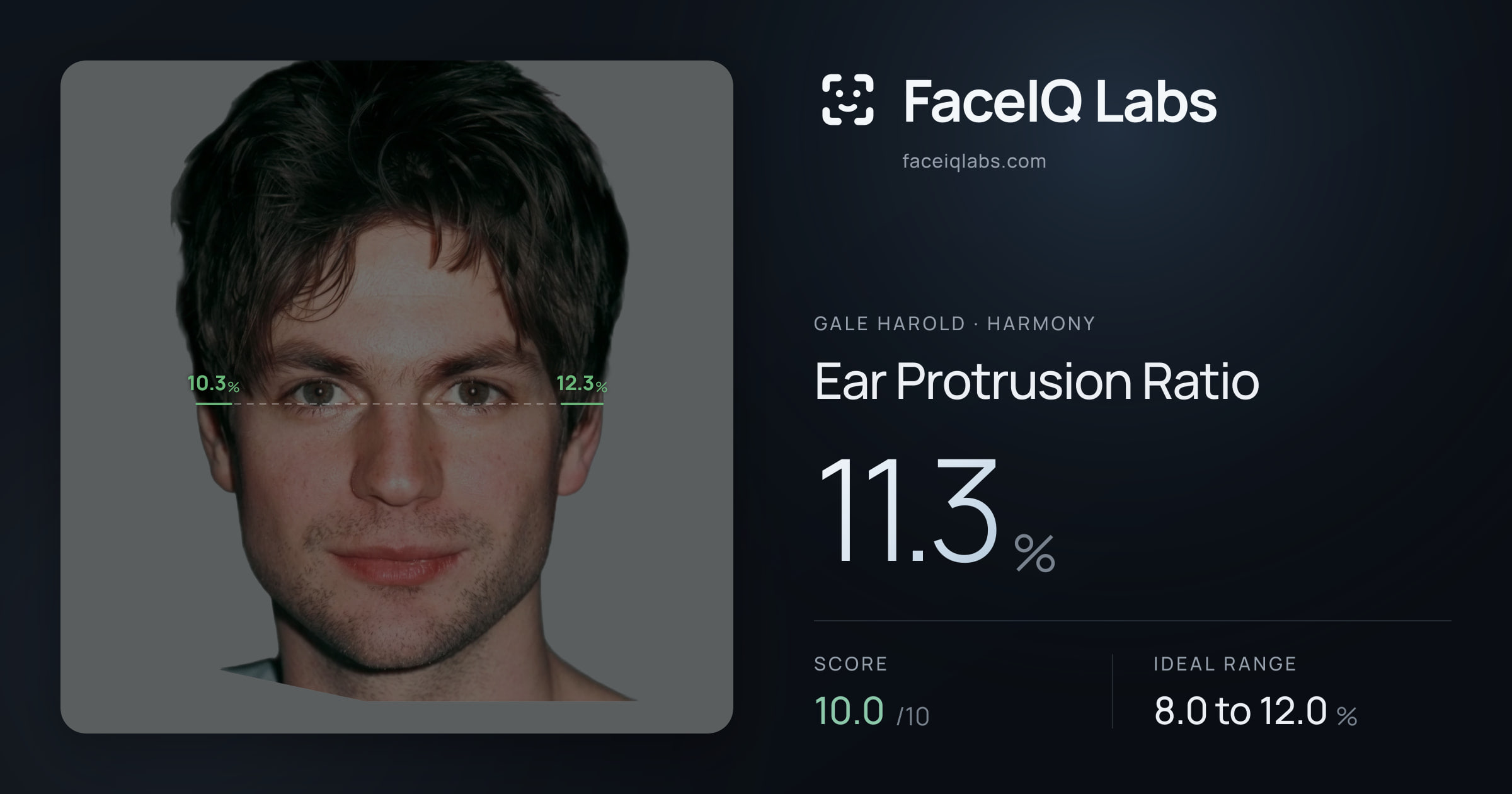 Gale Harold Ear Protrusion Ratio: 11.3%, drawn on the photo