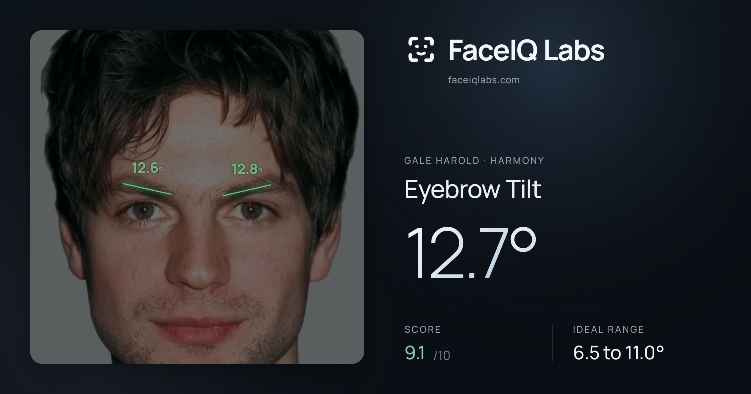 Gale Harold Eyebrow Tilt: 12.7°, drawn on the photo