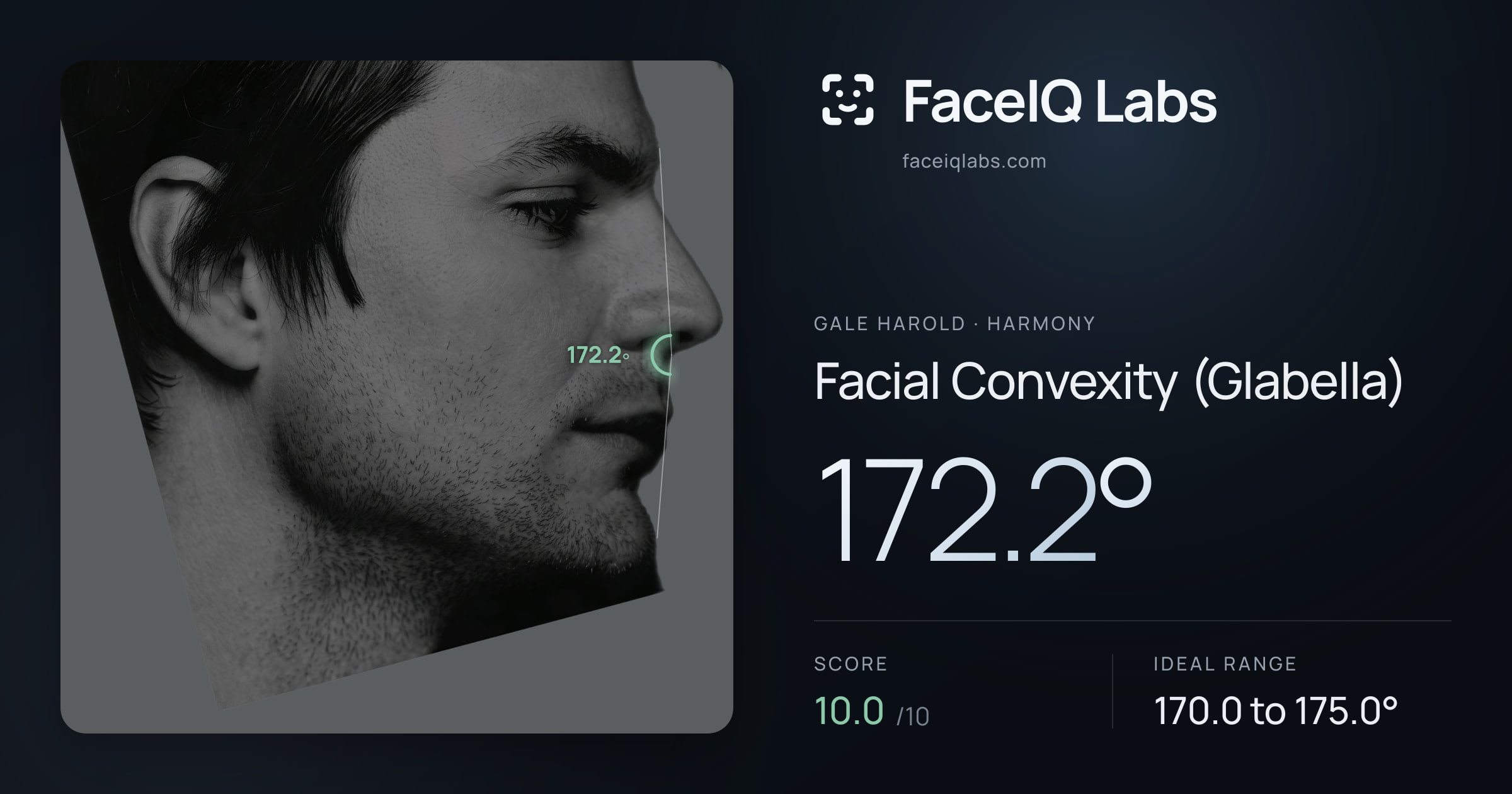 Gale Harold Facial Convexity (Glabella): 172.2°, drawn on the photo