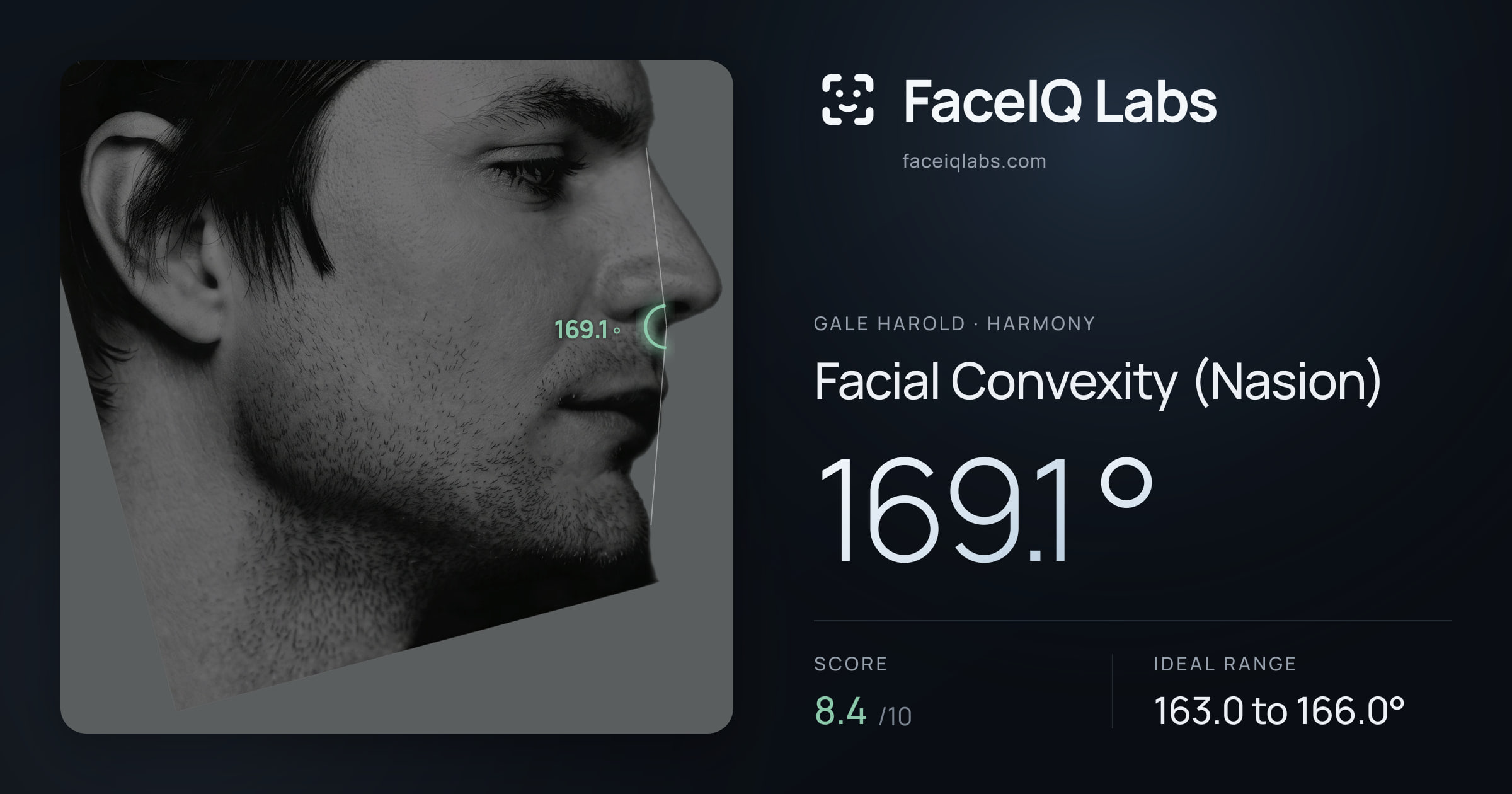 Gale Harold Facial Convexity (Nasion): 169.1°, drawn on the photo