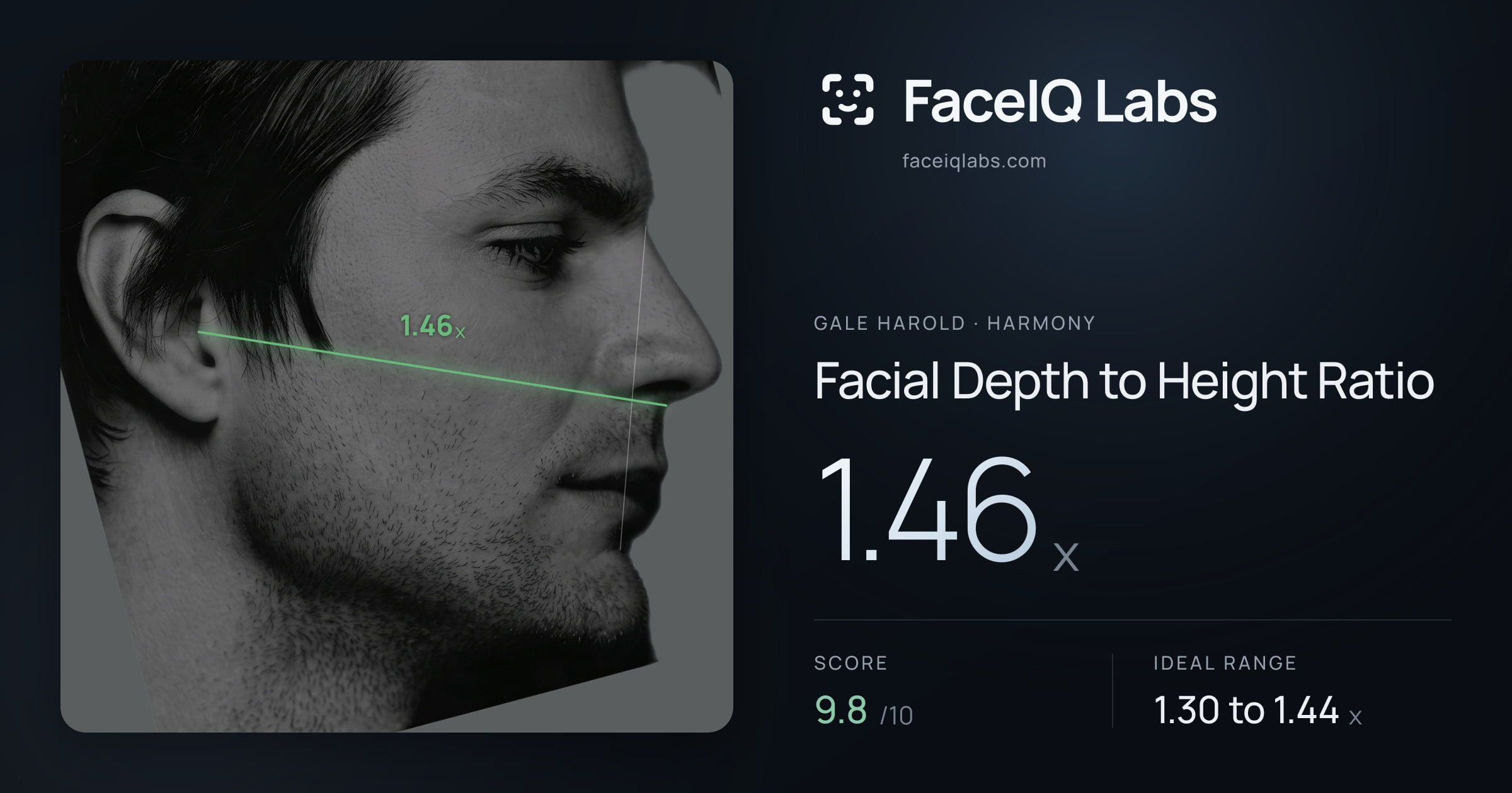 Gale Harold Facial Depth to Height Ratio: 1.46x, drawn on the photo