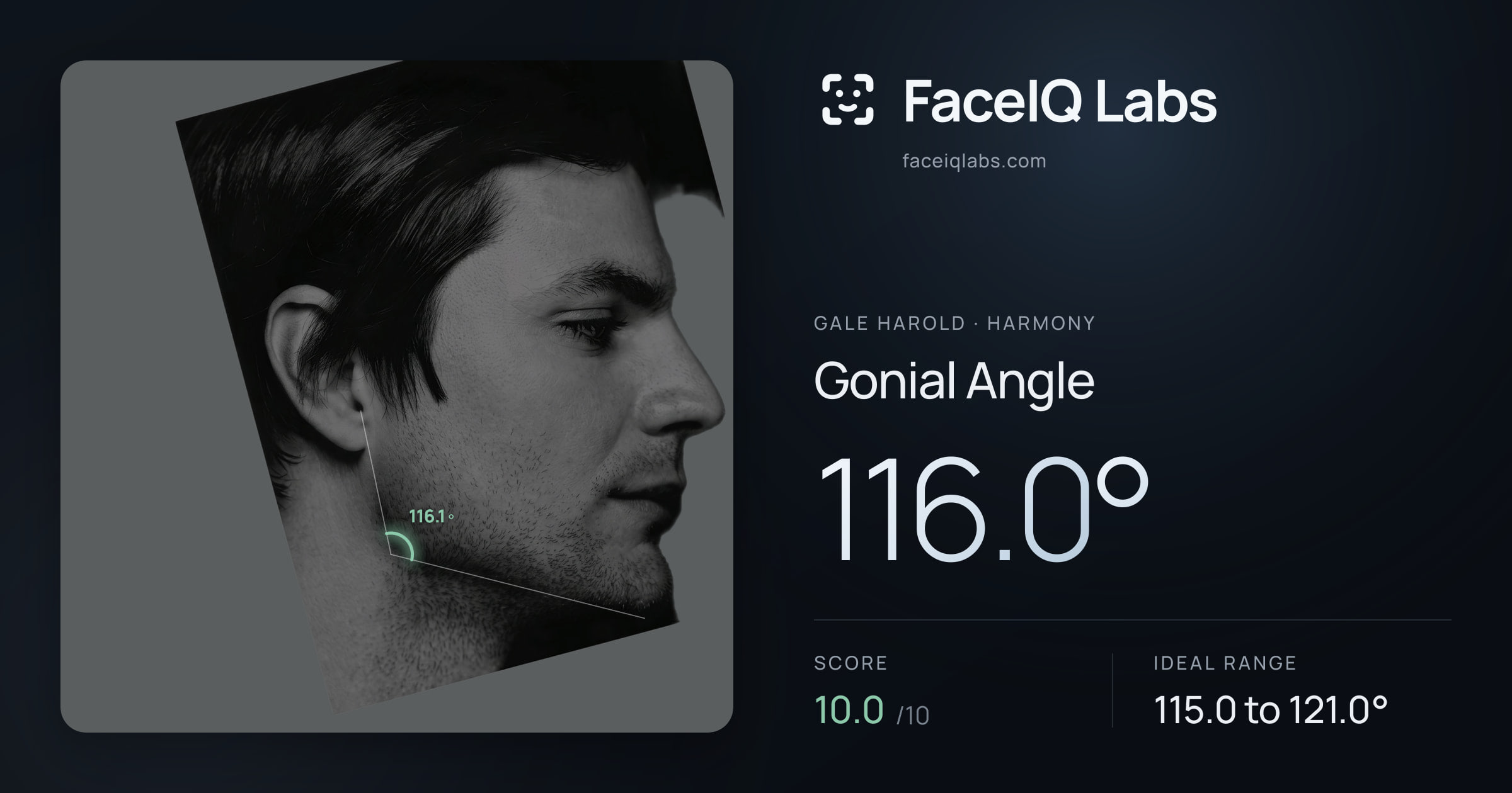 Gale Harold Gonial Angle: 116.0°, drawn on the photo