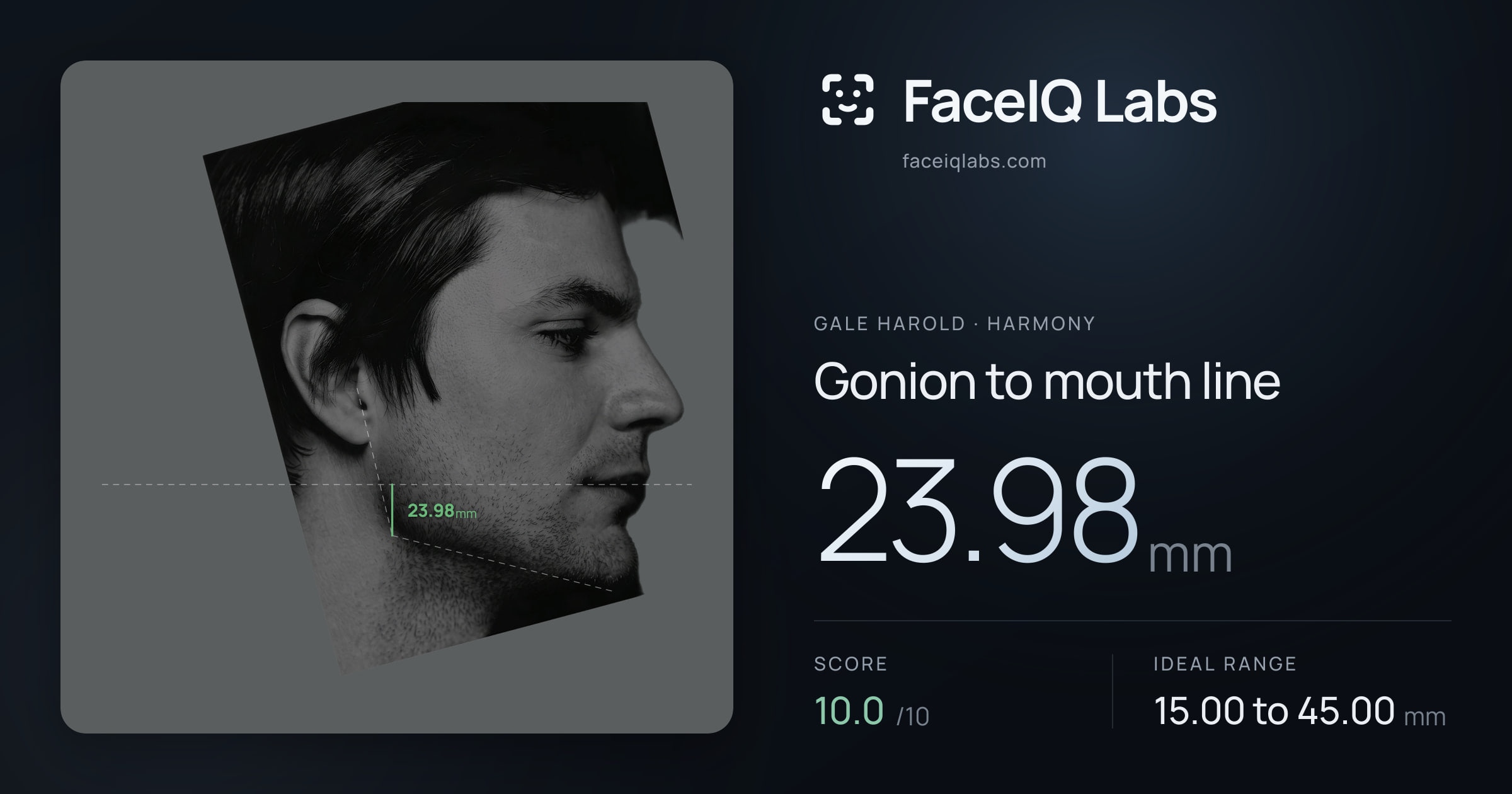 Gale Harold Gonion to mouth line: 23.98mm, drawn on the photo