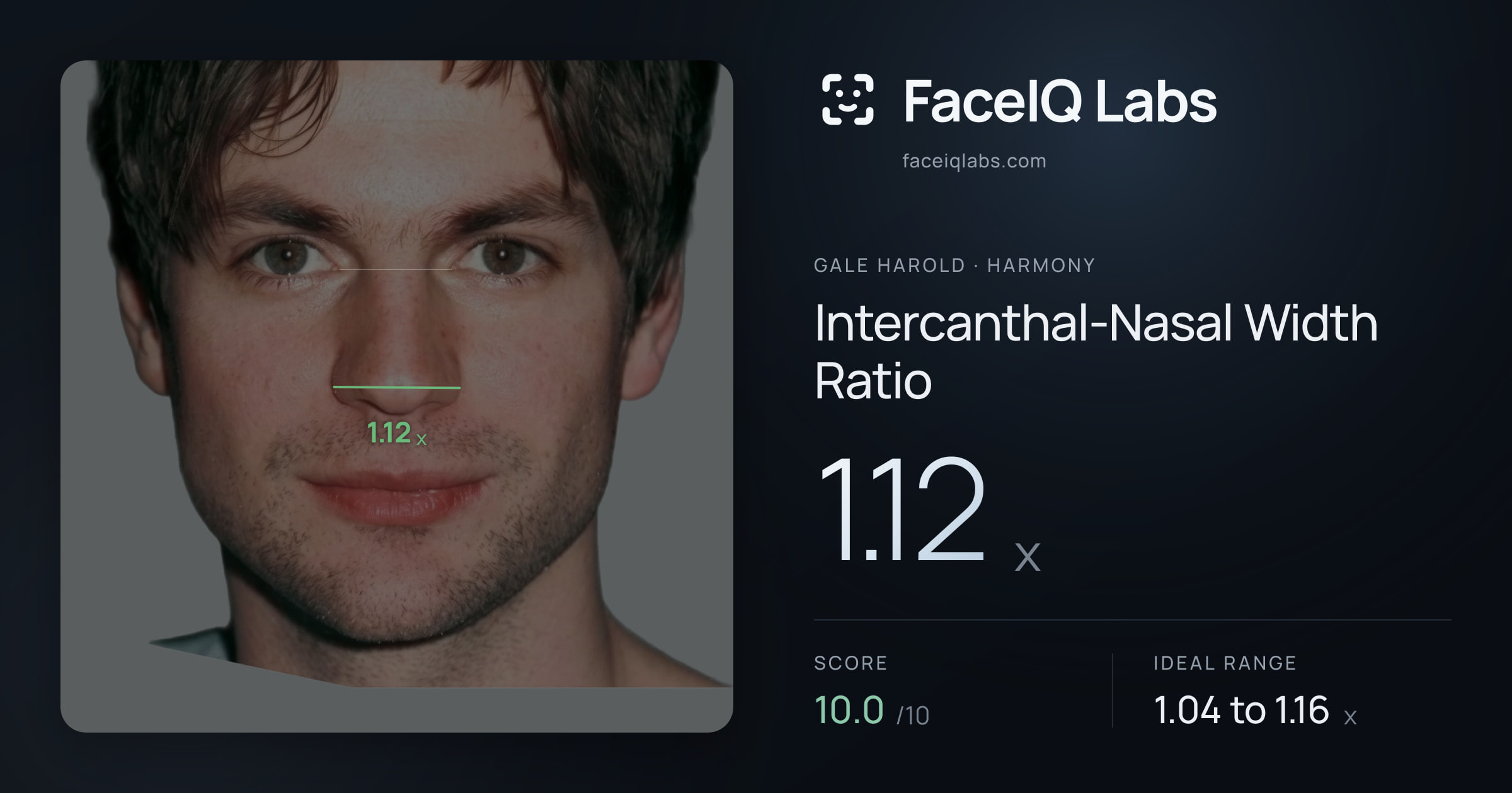 Gale Harold Intercanthal-Nasal Width Ratio: 1.12x, drawn on the photo