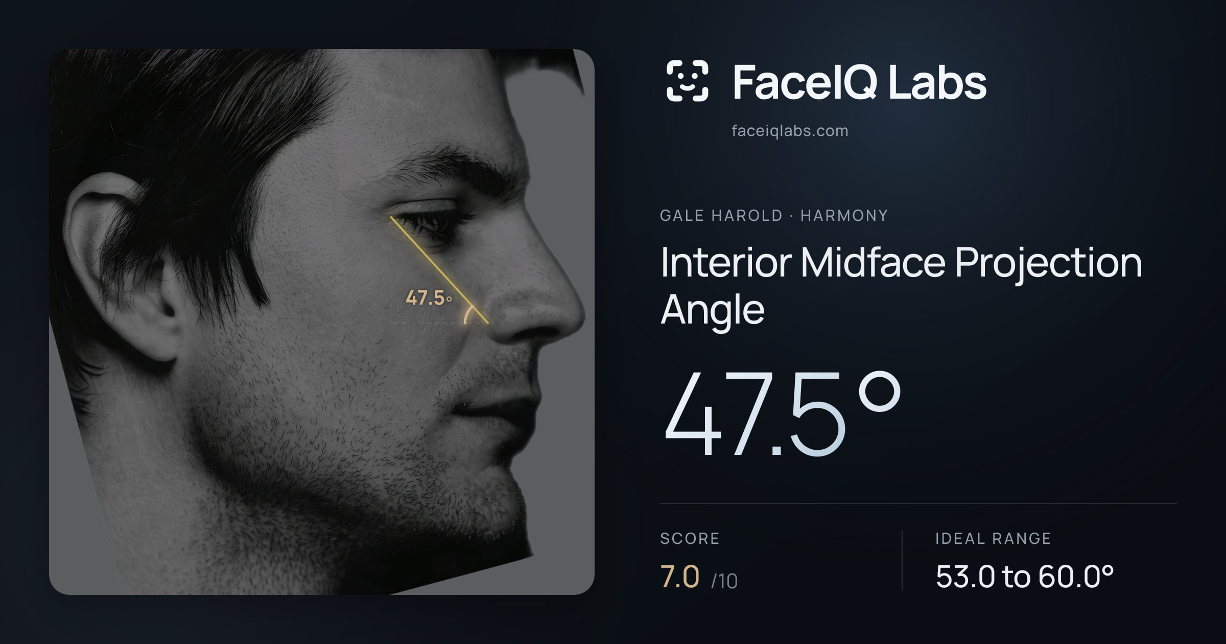 Gale Harold Interior Midface Projection Angle: 47.5°, drawn on the photo
