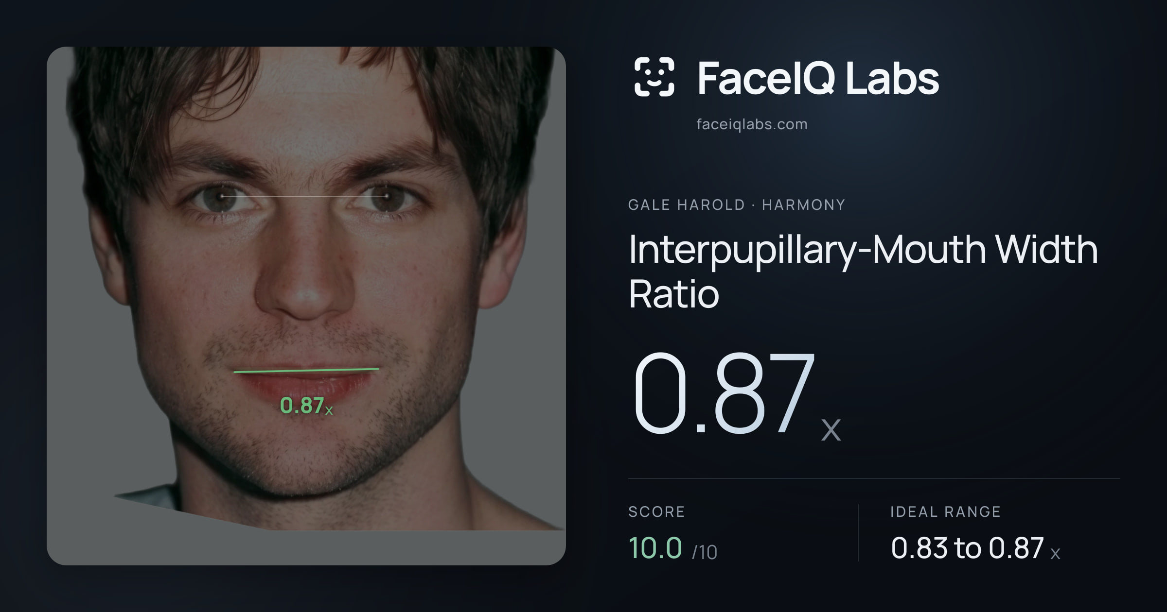 Gale Harold Interpupillary-Mouth Width Ratio: 0.87x, drawn on the photo