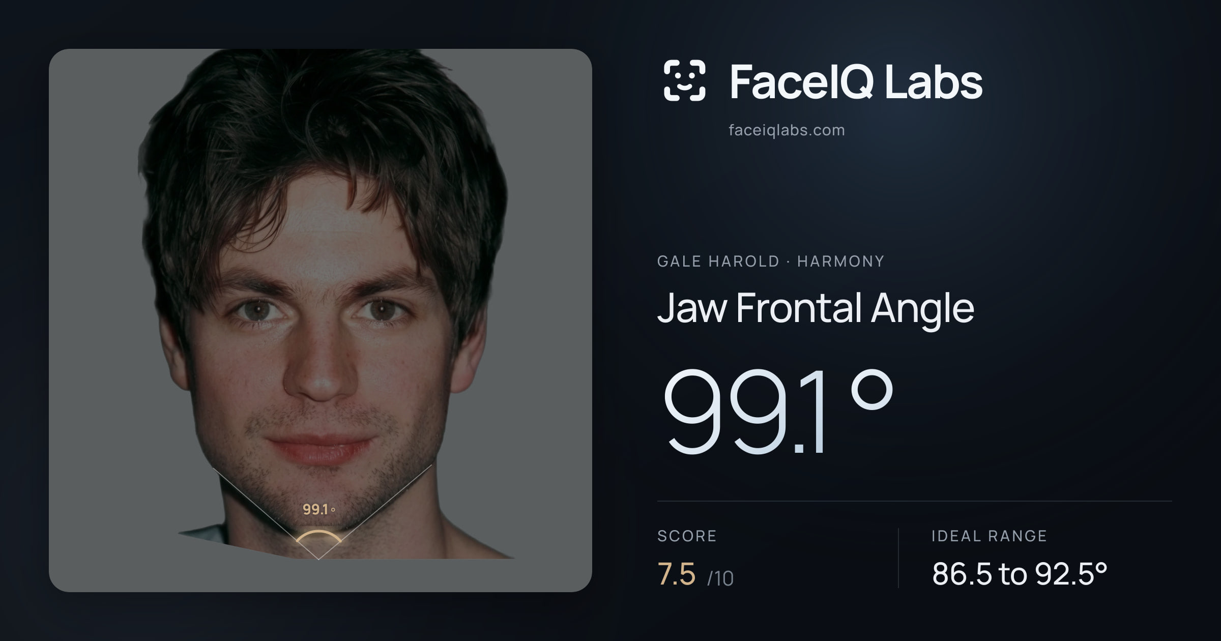 Gale Harold Jaw Frontal Angle: 99.1°, drawn on the photo