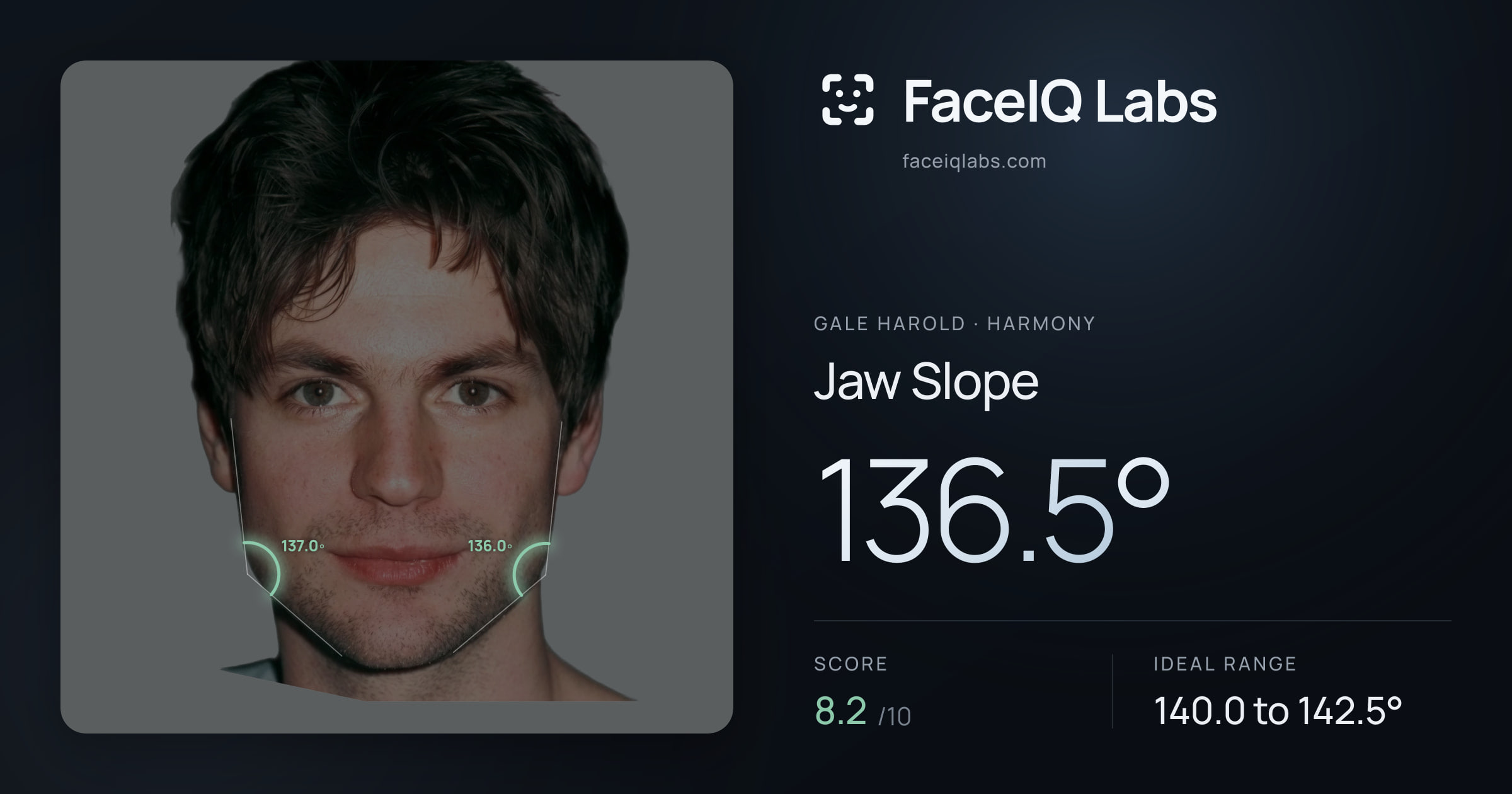 Gale Harold Jaw Slope: 136.5°, drawn on the photo