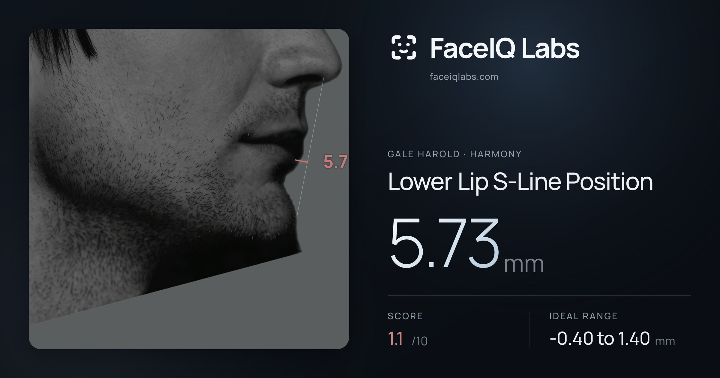 Gale Harold Lower Lip S-Line Position: 5.73mm, drawn on the photo