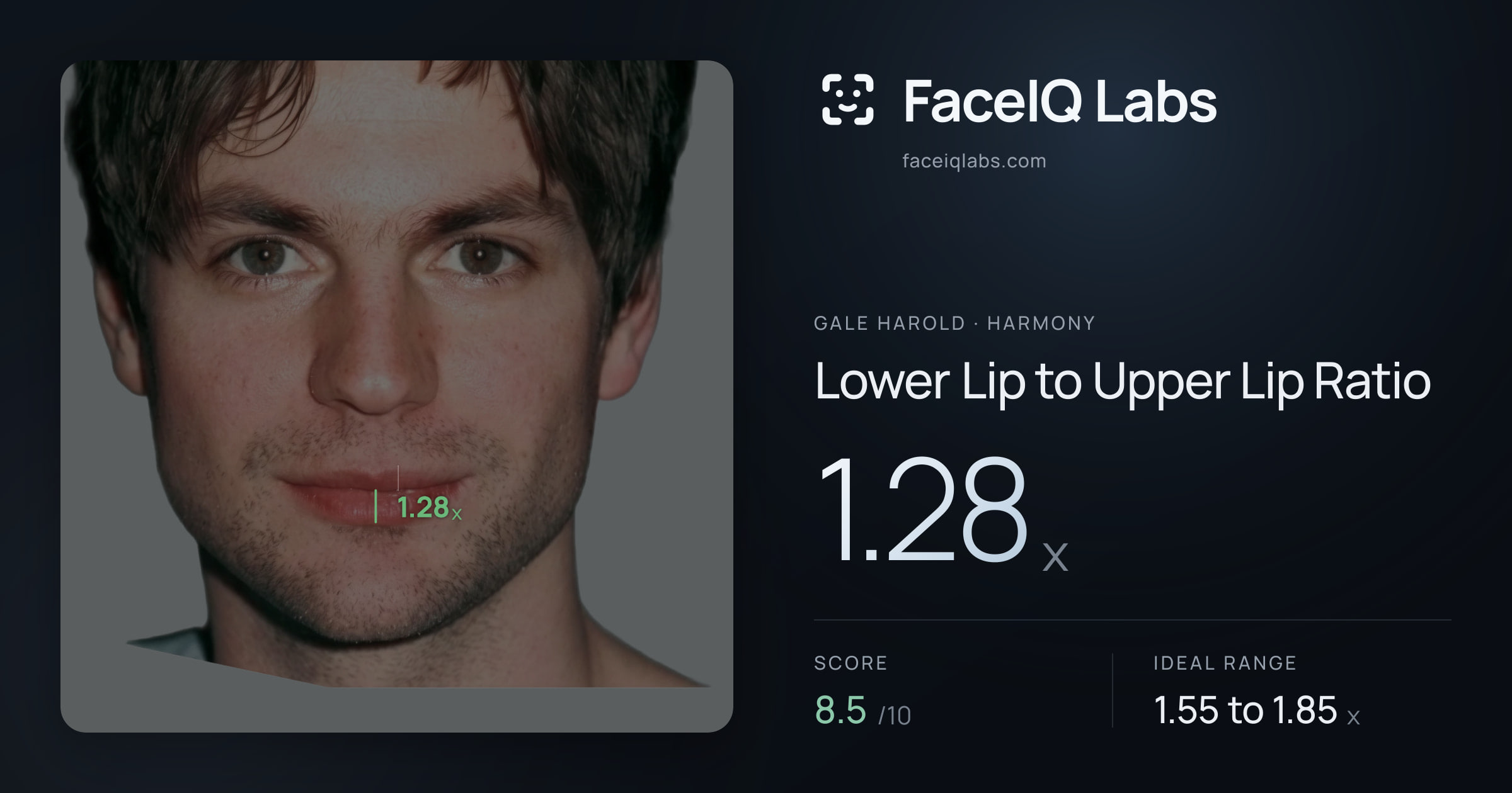 Gale Harold Lower Lip to Upper Lip Ratio: 1.28x, drawn on the photo