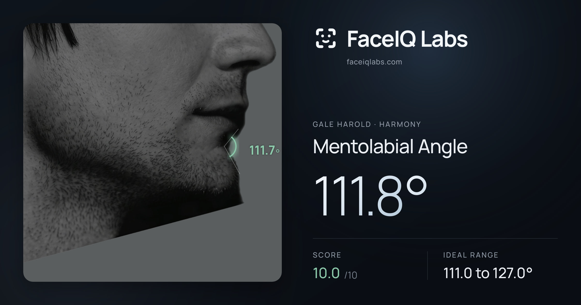 Gale Harold Mentolabial Angle: 111.8°, drawn on the photo